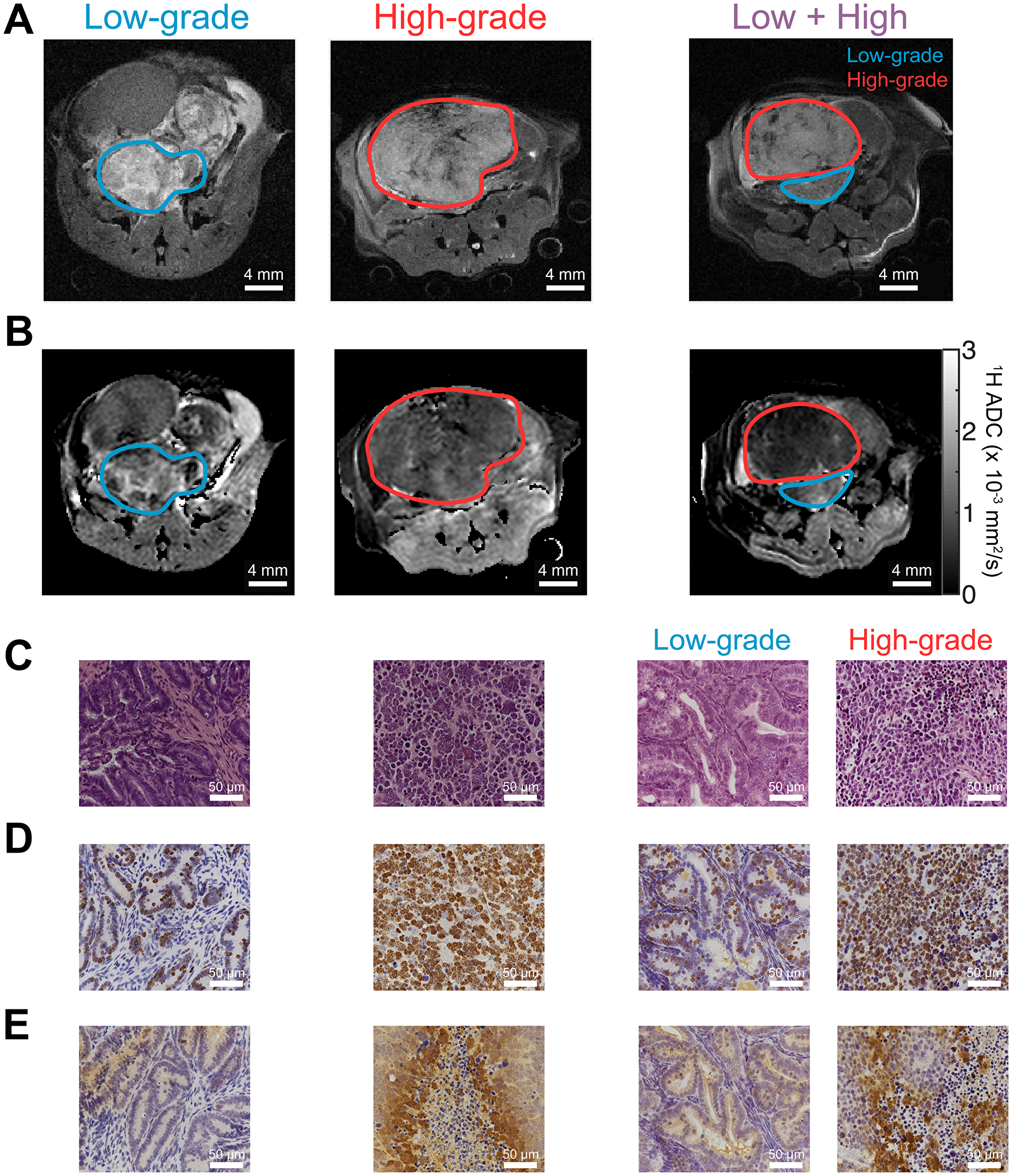 1H MR imaging and histological staining of TRAMP tumor tissue display differences in aggressive phenotype