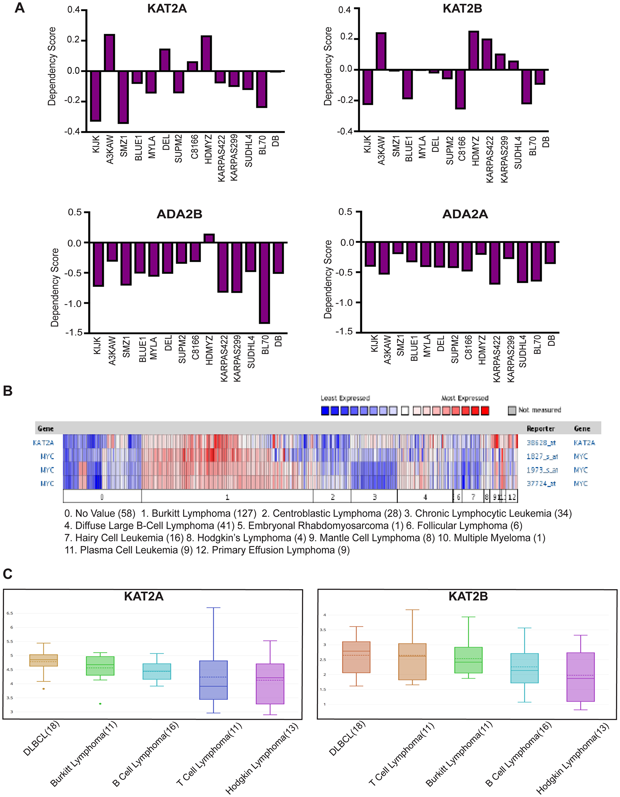 GCN5 and SAGA is implicated in human Burkitt Lymphoma