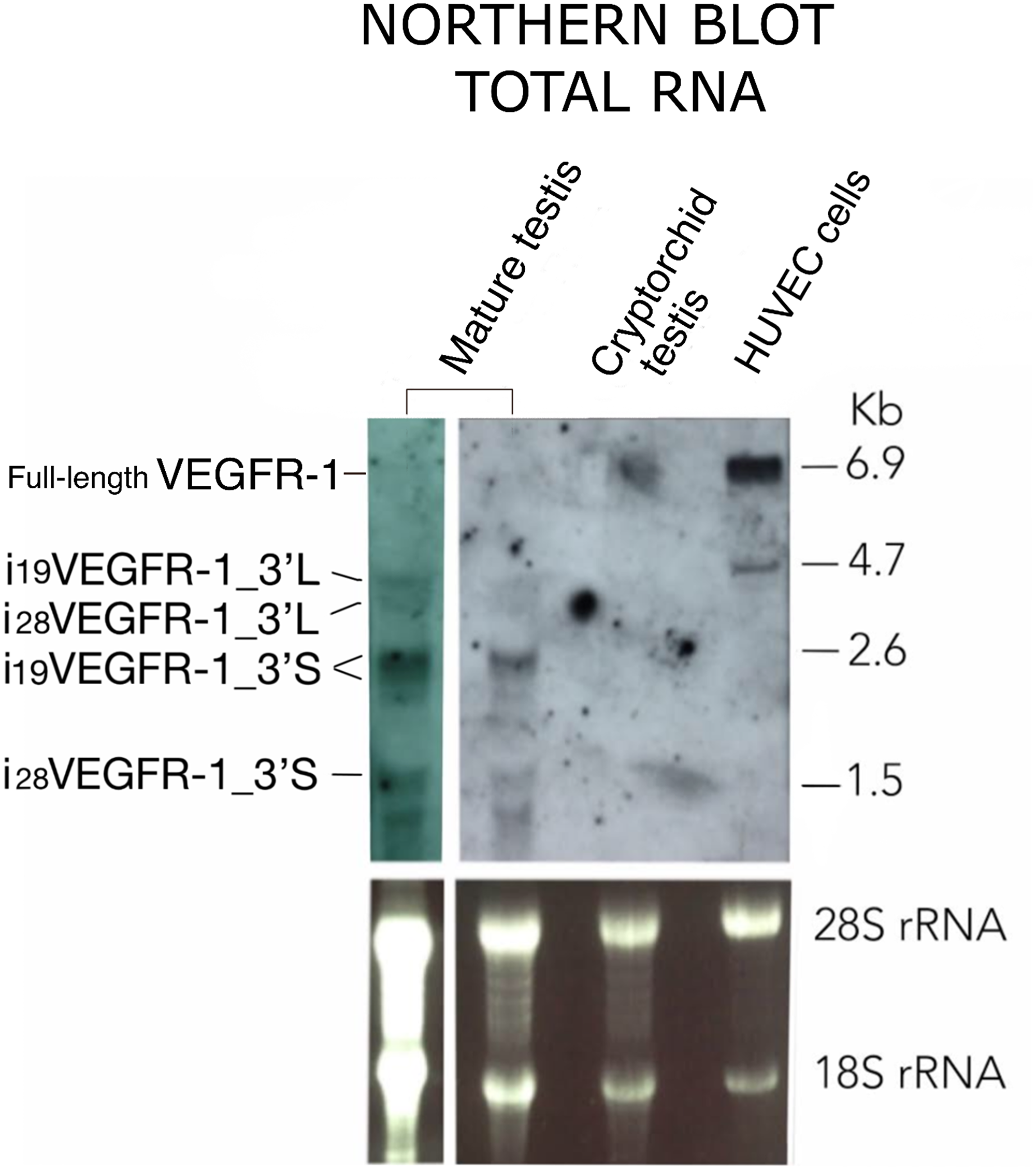 Northern blot pattern of VEGFR-1 from total RNA expressed in mature testis, cryptorchid testis and HUVEC cells as indicated