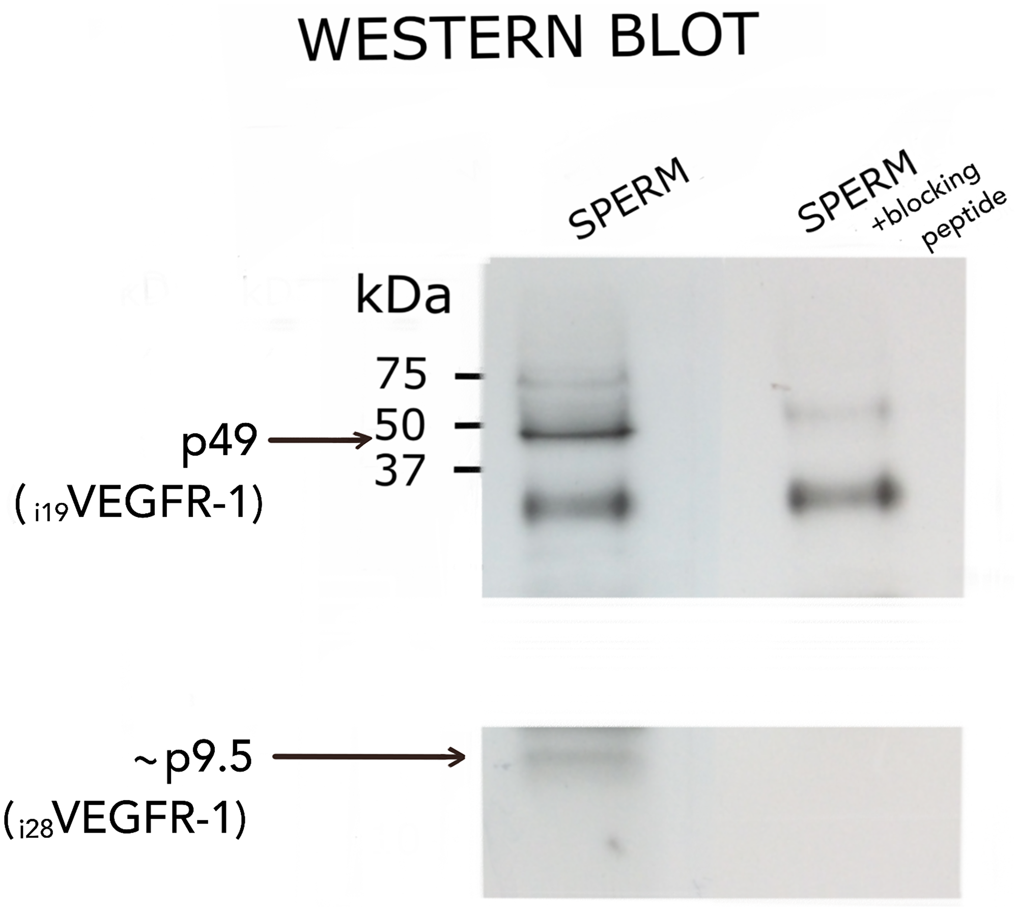 Western blot analysis of i19VEGFR-1 (p49) (49kDa) and putative i28VEGFR-1 (p9.5) (9.5kDa) isoforms expressed in normal sperm samples