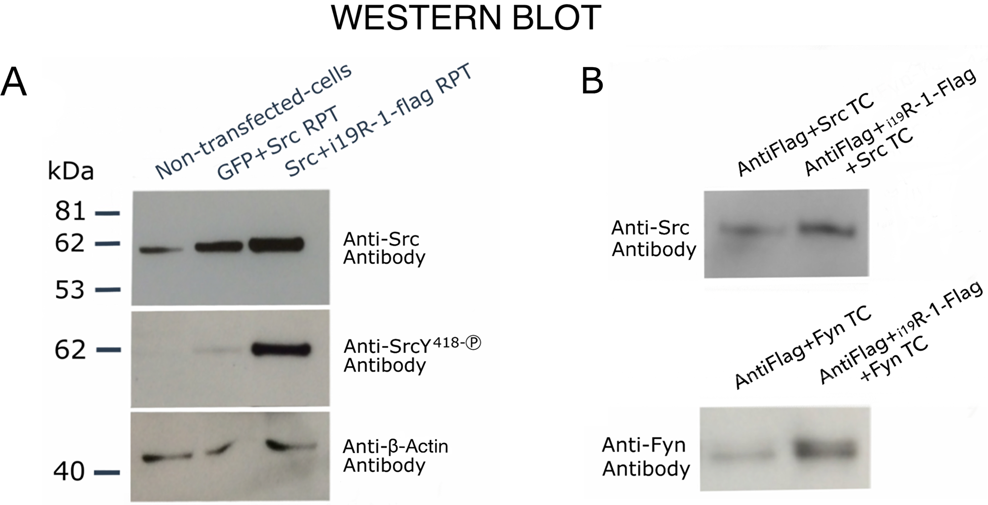 Western blot analysis showing transphosphorylating activity and binding of i19VEGFR-1 on Src kinases