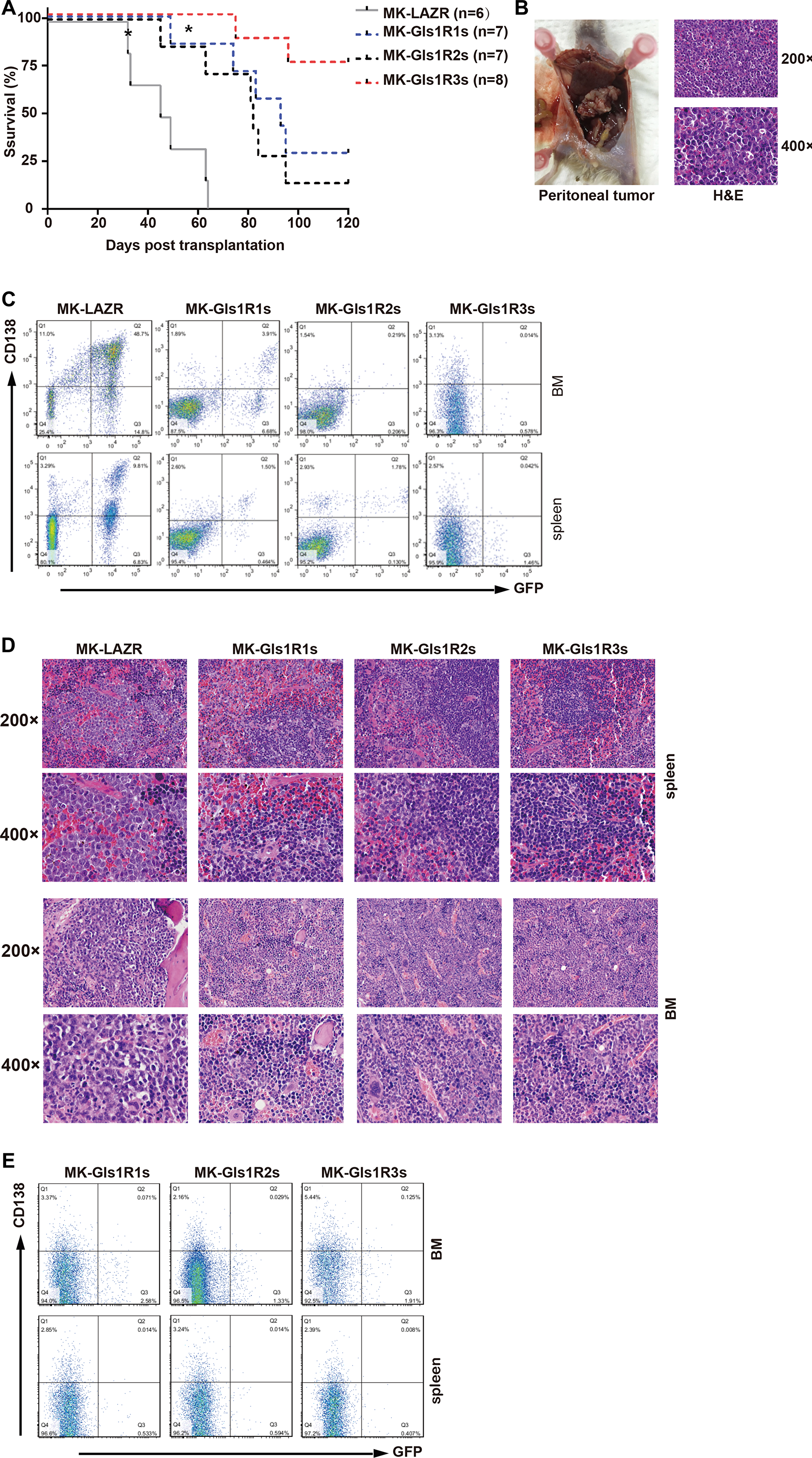 Down-regulation of Gls1 impeded cMYC/KRAS12V-transduced PCTs in Balb/c mice