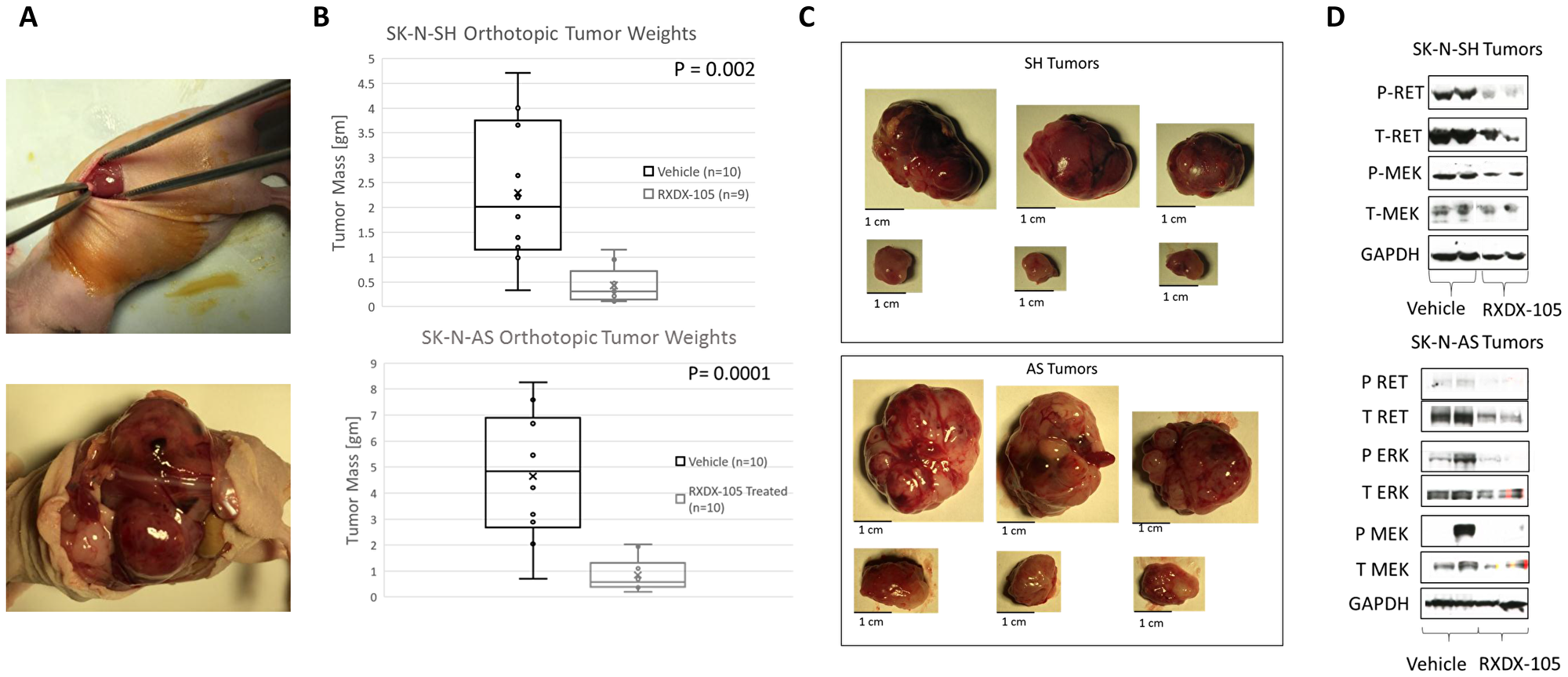 RXDX-105 inhibits tumor xenograft growth and inhibits RET phosphorylation and intracellular signaling in orthotopic neuroblastoma tumors
