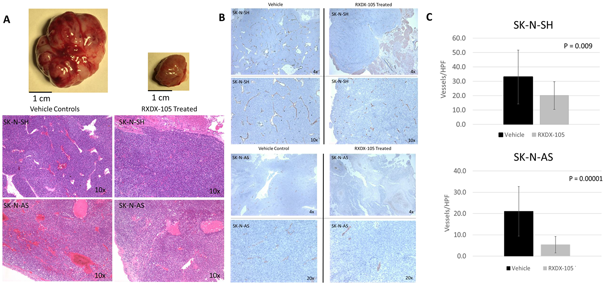 RXDX-105 treatment leads to decreased angiogenesis in vivo