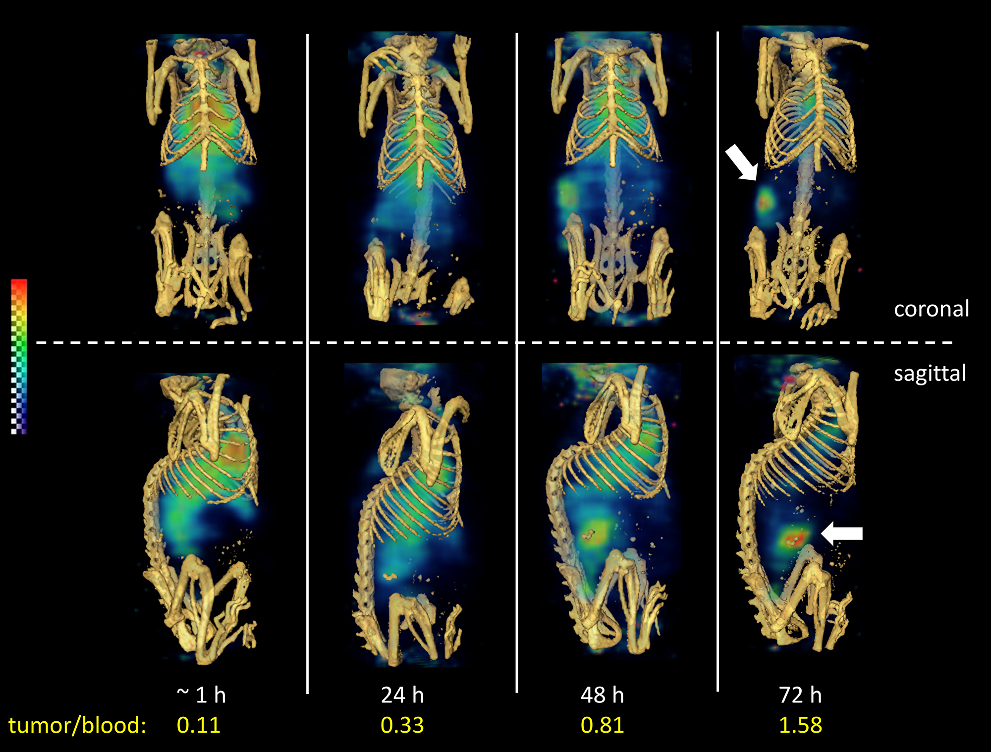 Reconstructed three-dimensional volume rendered SPECT-CT fusion images of 111In-ADC (without predose) administered to LuCaP96.1 tumor explant bearing mice intravenously