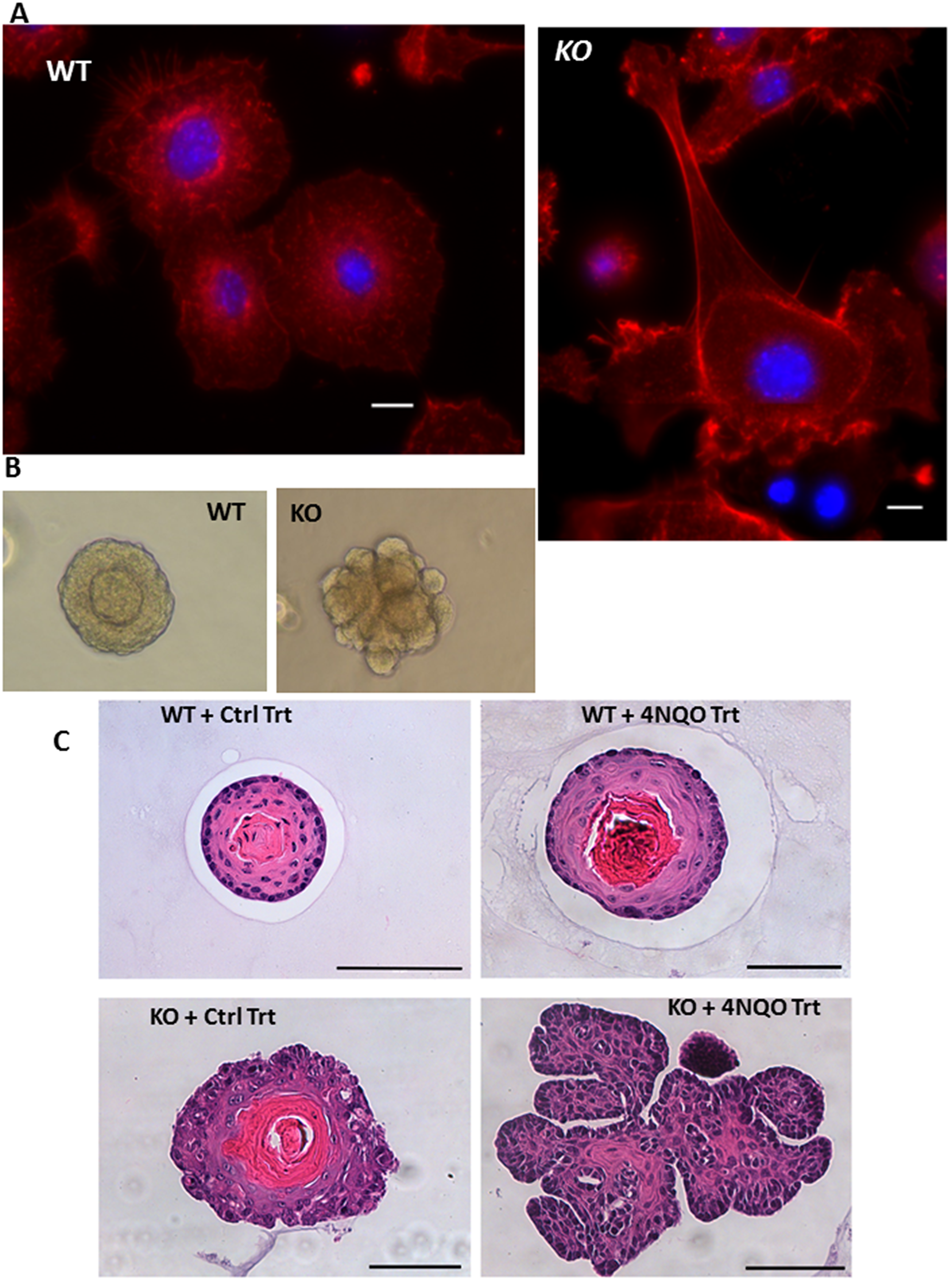 Altered morphology of MPV17-/- organoids