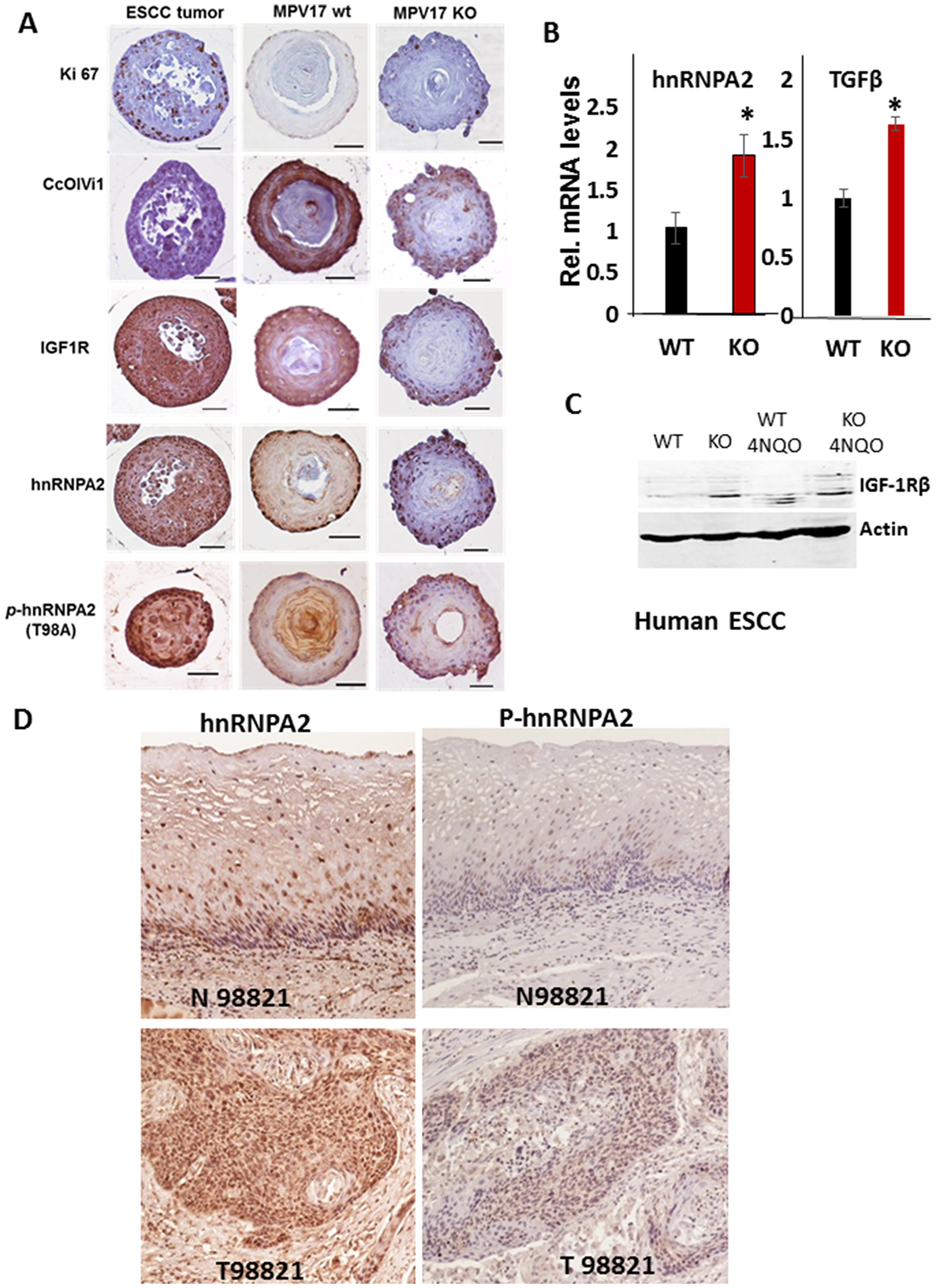 MPV17-/- esophageal 3D organoids show elevated expression of oncogenic MtRS marker proteins