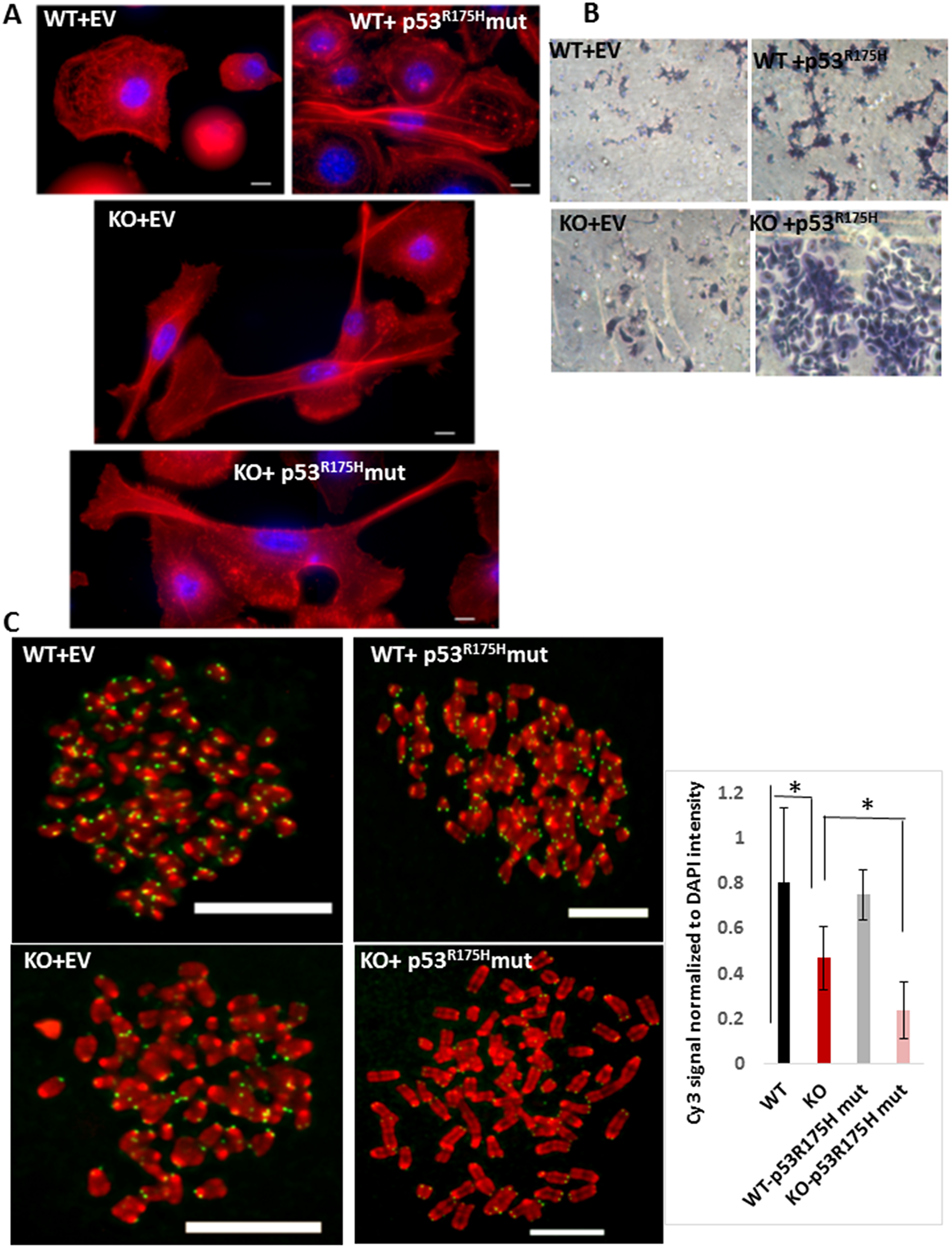 (A) Phalloidin staining of F-actin (red) and nucleus (DAPI, blue) in WT or MPV17-/- EECs expressing the empty adenoviral vector (control) or the TP53R175H mutant (as indicated) imaged under 100x objective in Leica wide field microscope. KO cells were imaged in multiple fields under same magnification and image tiles were stitched. (B) Representative bright field images showing the in vitro Matrigel invasion in WT and MPV17-/- EEC expressing either the empty adenoviral vector (control) or the TP53R175H mutant. (C) Left: Representative images of telo-FISH of telomere Cy3-PNA probe (pseudo-colored in green) on metaphase spreads (pseudo-colored in green) in WT and MPV17-/- EECs expressing the empty adenoviral vector (control) or the TP53R175H mutant (as indicated) imaged under 100x objective in Leica wide field microscope. Scale bars indicate 10 µm. Right: Quantitation of the telo-FISH metaphases (n = 5 to 10 per cell type). Significance p $!--ESC