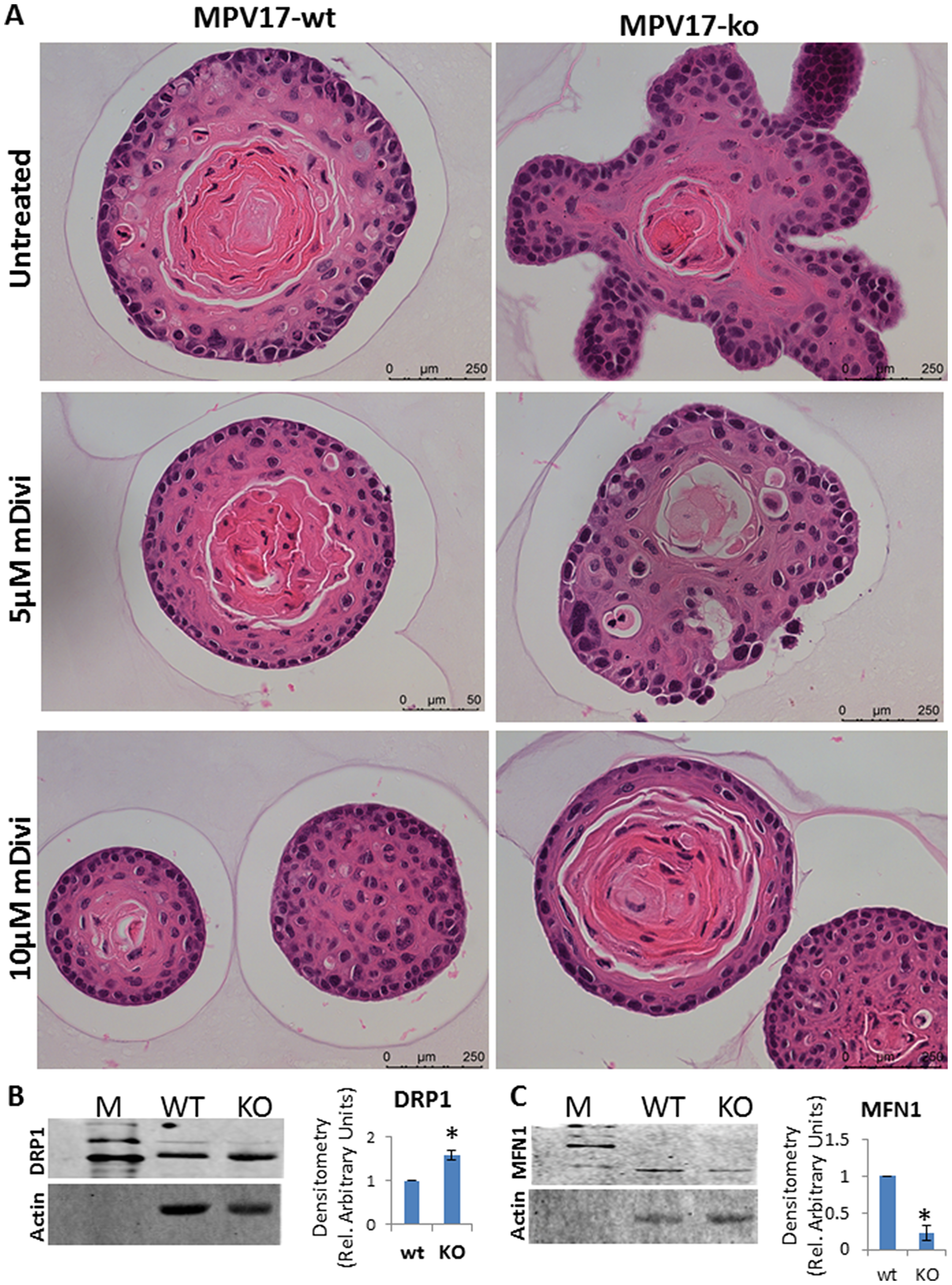 (A) Representative bright field images of H&E stained WT and MPV17-/- esophageal organoids treated with DRP1 inhibitor mDivi-1 as indicated in the figure. Treatment was started at day 5 of the organoid culture. (B, C, left panel) Representative western immunoblot from 50 µg total cell lysates from WT and MPV1717-/- EECs showing protein levels of mitochondrial (B) fission marker protein DRP1 and (C) fusion marker protein MFN1. (B, C right panel) Densitometry analysis from two replicate blots. *P $!--ESC