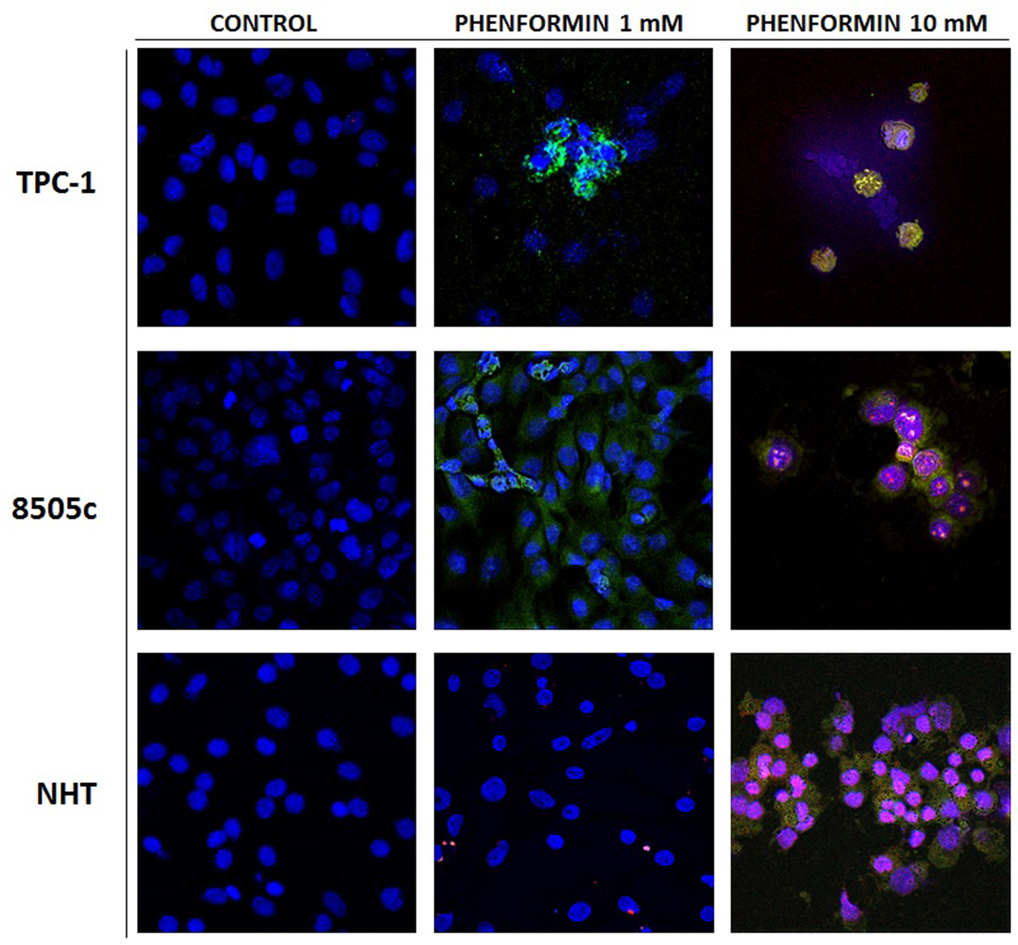 Apoptosis induced in treated thyroid cancer cell lines observed with Annexin V-FITC/PI stain under confocal fluorescent microscope (40× magnification)