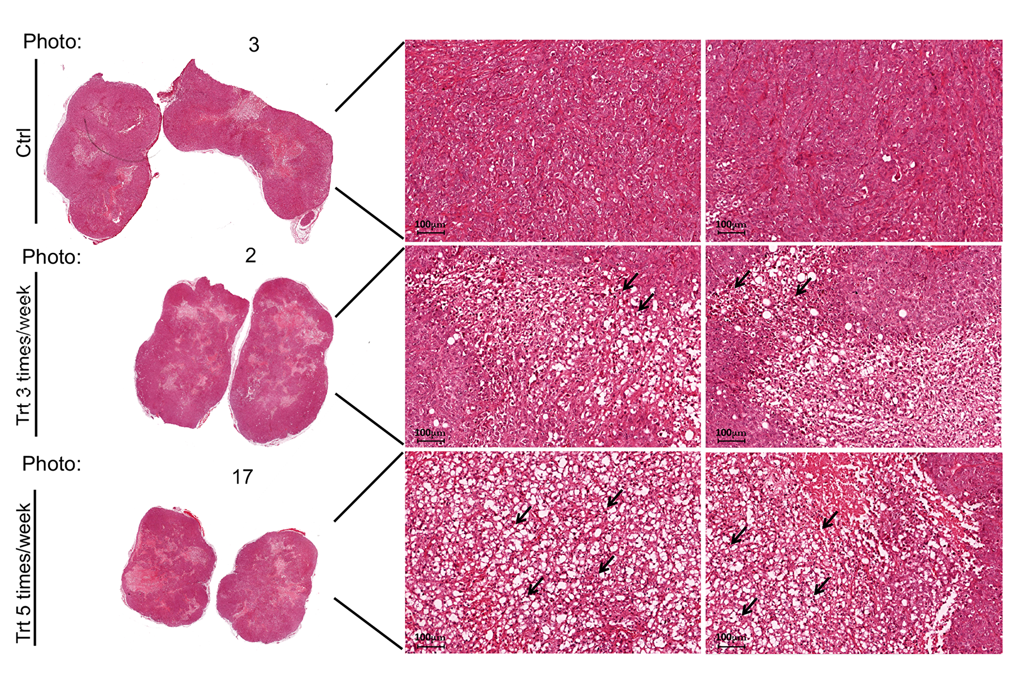 PJ34 induces necrosis in PANC1 tumors of the treated mice
