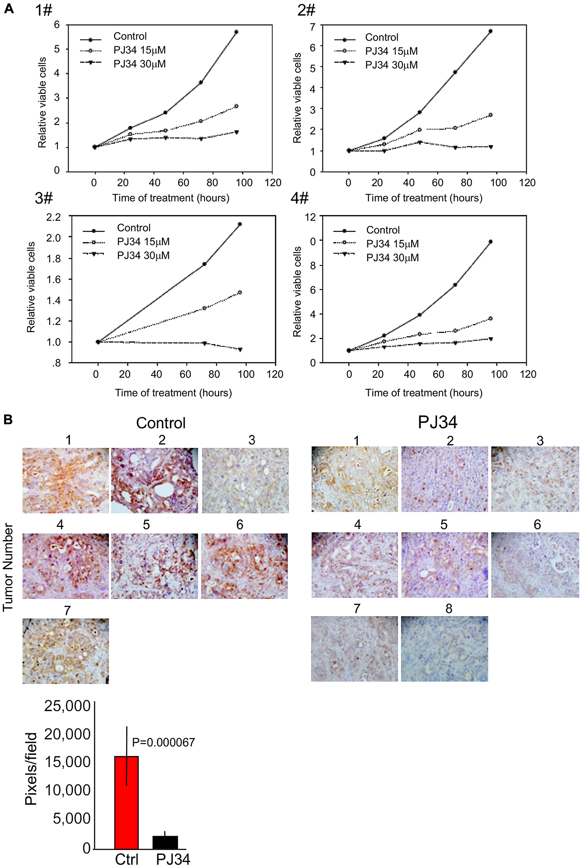 PJ34 cytotoxicity in patients-derived pancreas cancer cells