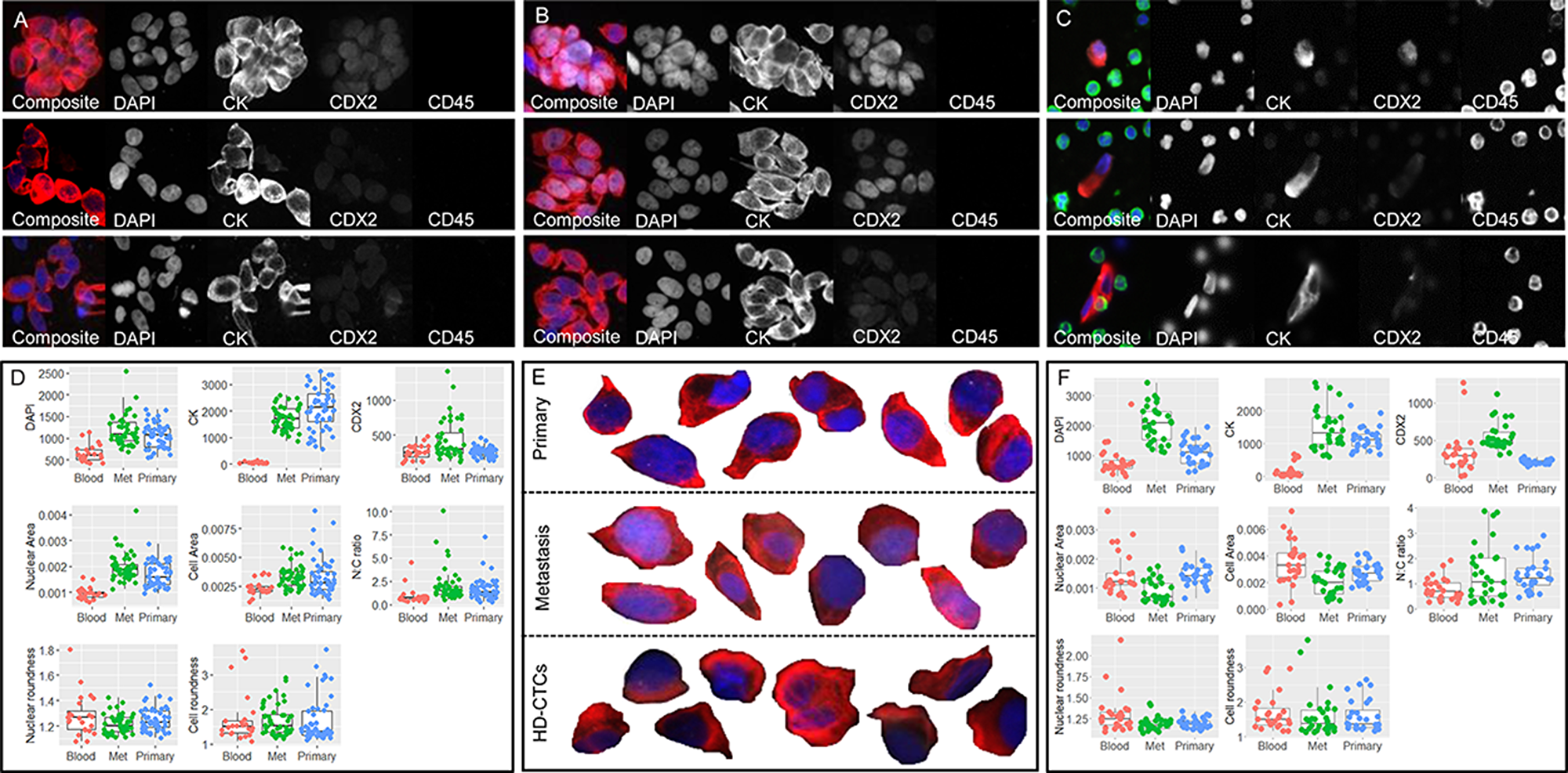 Primary, metastatic and HD-CTC comparison for patients CRC703 (A–D) and CRC009 (E–F). Tumor touch preps from (A) primary CRC tumor and (B) hepatic metatasis. (C) Liquid biopsy HD-CTCs. In A-C, each row shows one cell or cell cluster with the composite image followed by the 4 individual channels. (D) Selected raw measurements on all segmented single cells from patient CRC703. (E) Selected (enlarged) segmented composite images of primary CRC cells (top row), metastasis cells (middle row) and circulating HD-CTCs (bottom row). (F) Selected raw measurements on all segmented single cells from patient CRC009. The boxplots show Blood, HD-CTCs (red); Met, metastatic cells (green); Primary, primary CRC cells (blue). Measurements include mean pixel intensity (RFU) for DAPI, CK and CDX2, each measured using the same exposure across sample types for each patient, nuclear area and cell area (mm2), nuclear-to-cytoplasm (N/C) ratio, nuclear roundness and cell roundness (perimeter^2/(4*pi*area). Composite images show DAPI (blue), CK (red), CDX2 (white) and CD45 (green).