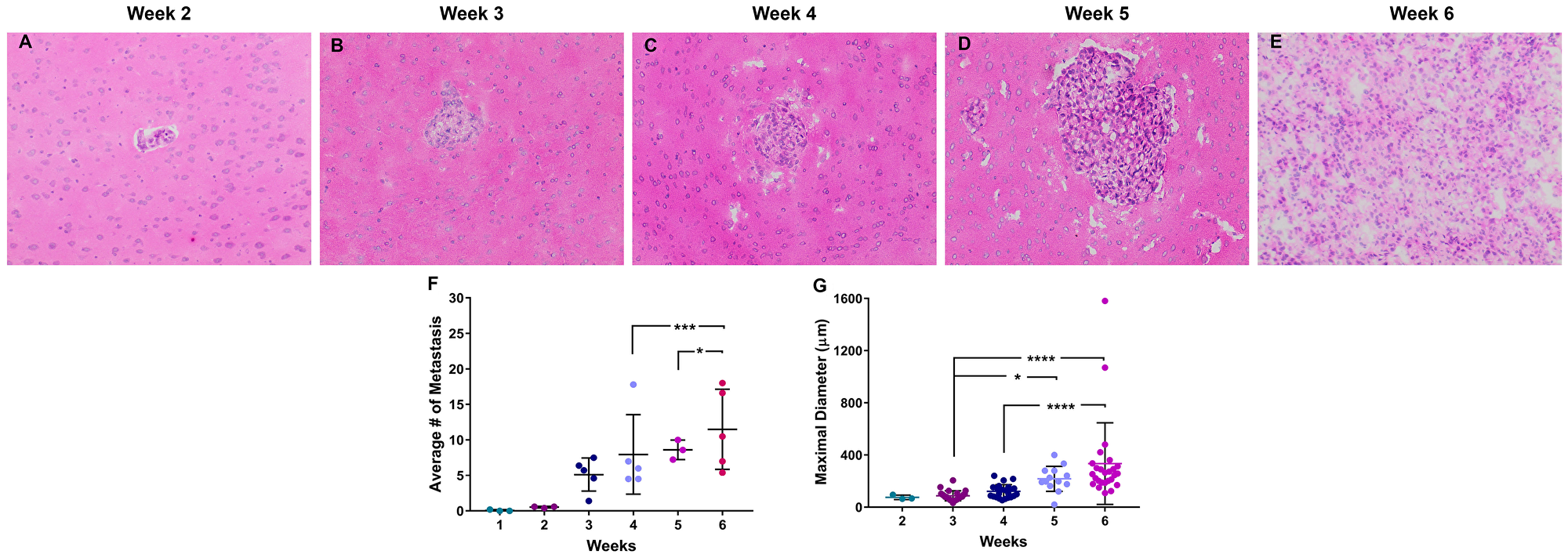 Histopathology of brain metastases of NSCLC