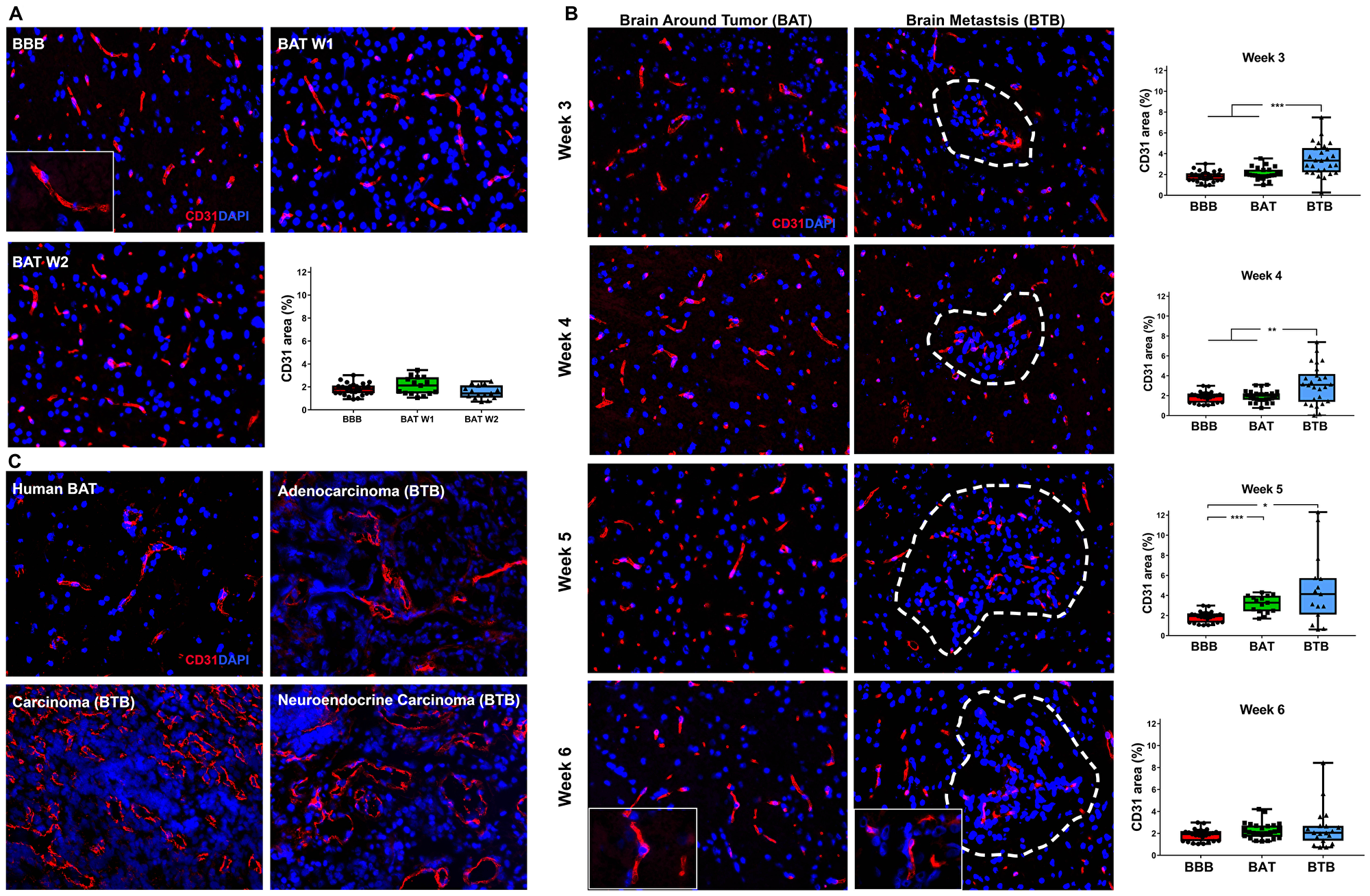 Increased expression of CD31 in brain metastases of NSCLC