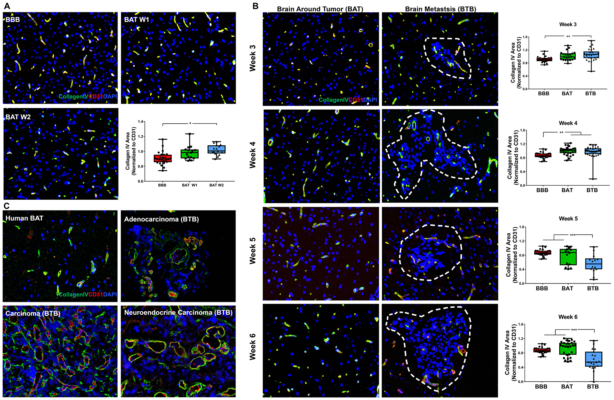 Collagen IV protein expression was diminished within late-stage NSCLC brain metastasis
