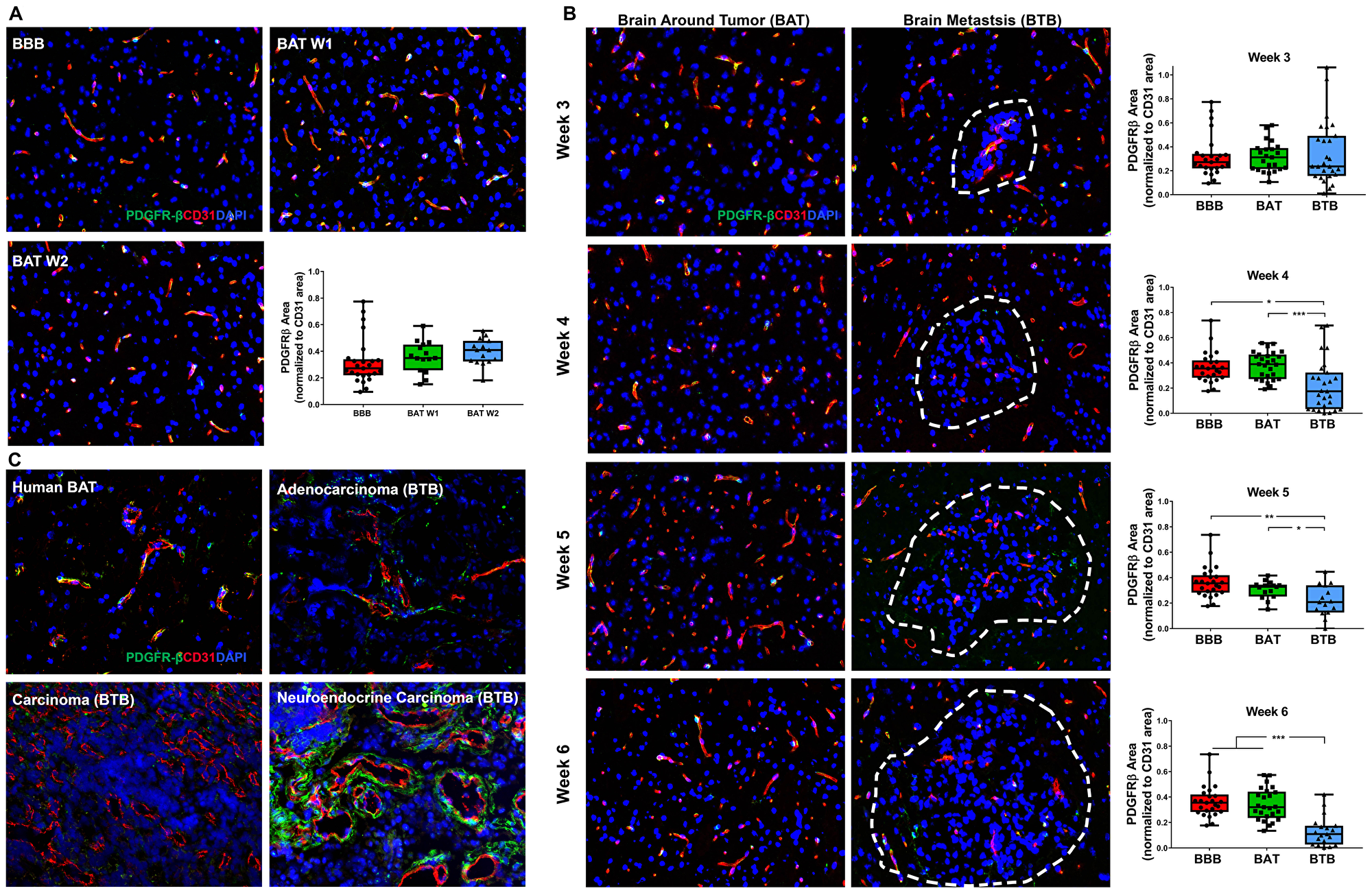 Loss of PDGFR-β protein expression in NSCLC brain metastases