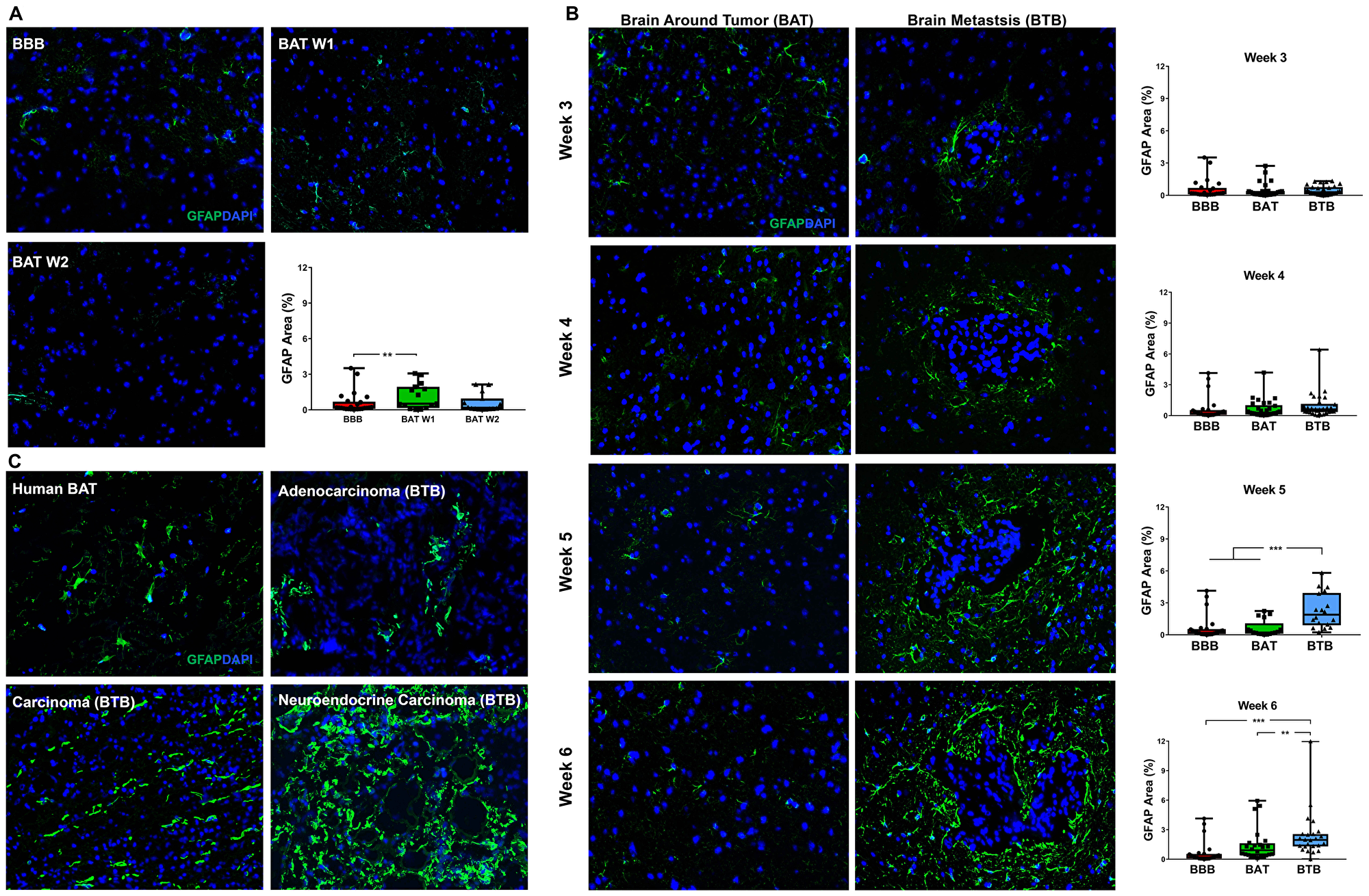 Reactive astrocytosis in NSCLC brain metastases