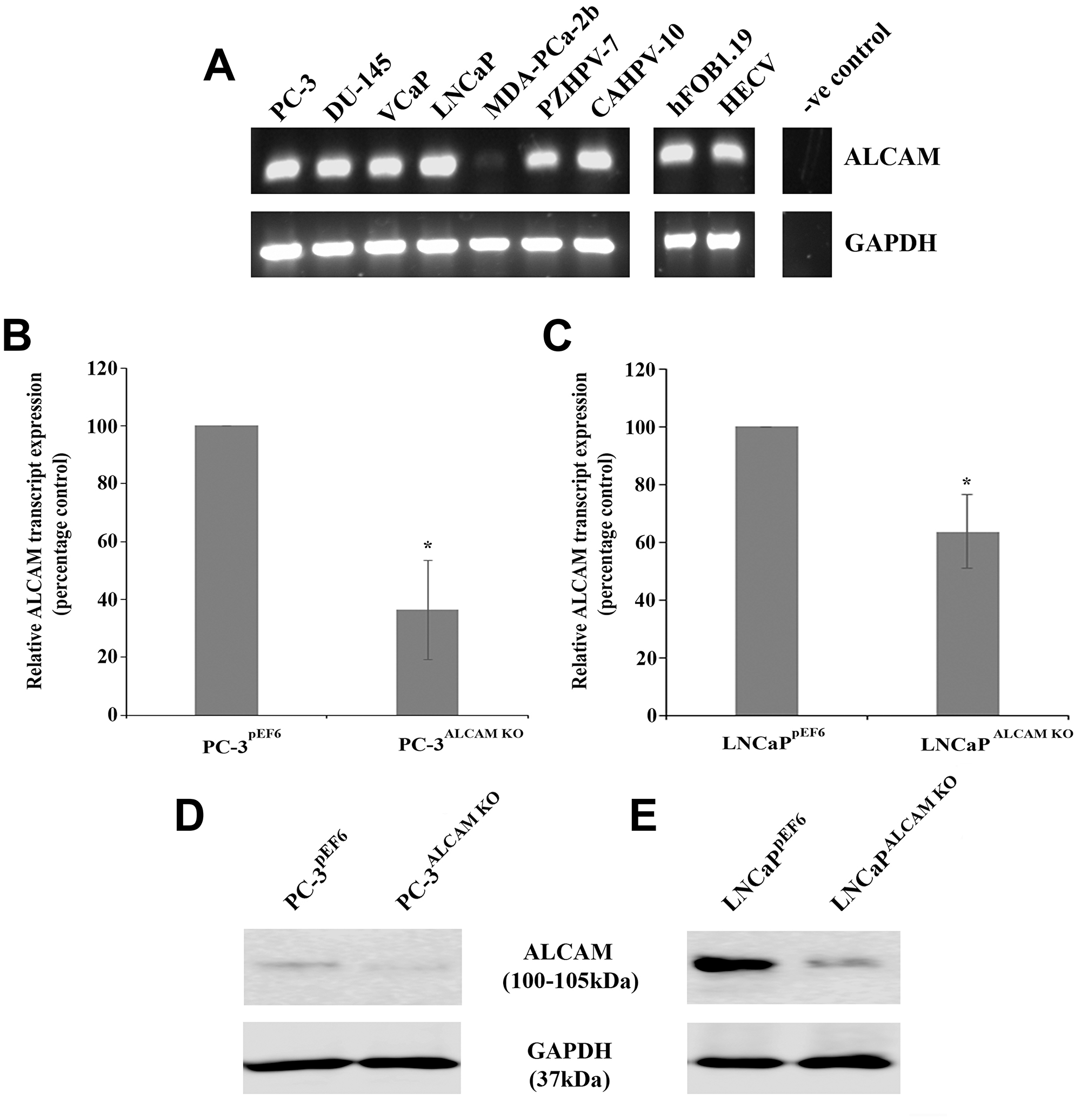 ALCAM expression and targeting in prostate cancer cell lines
