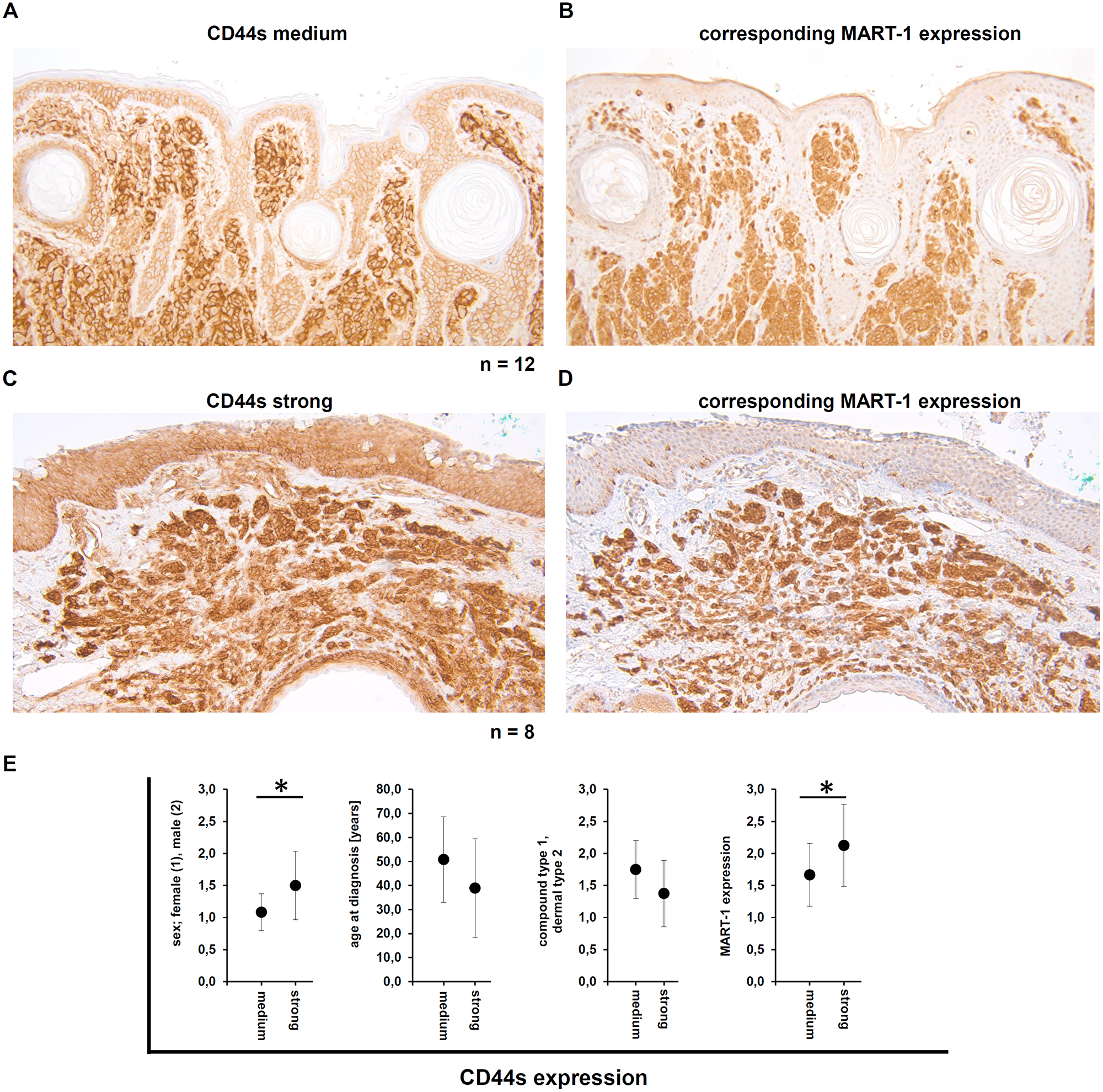 Demonstration of the CD44s and the corresponding MART-1 expression in human melanocytic nevi