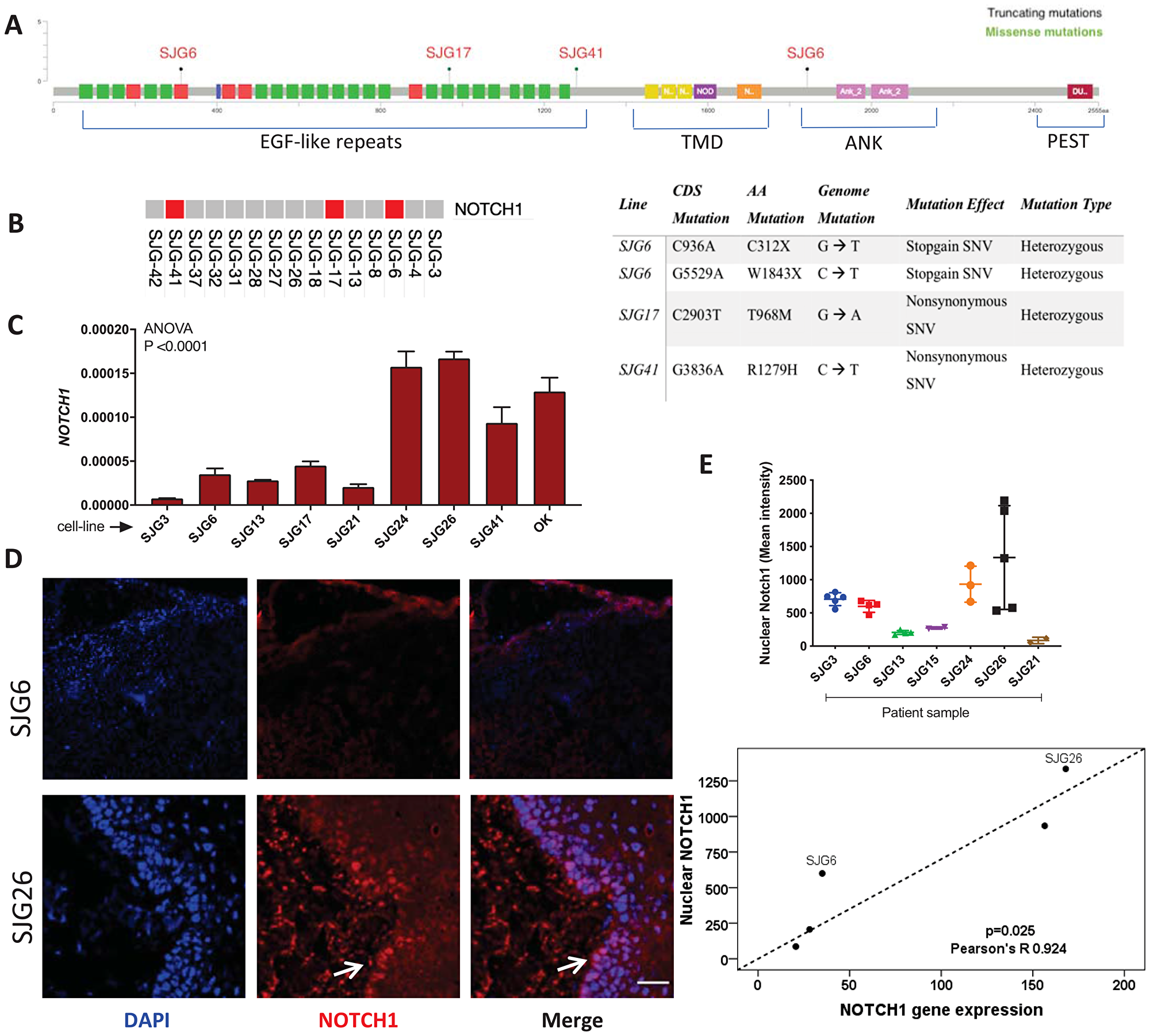 NOTCH1 expression in OSCC cell lines and parental tumours