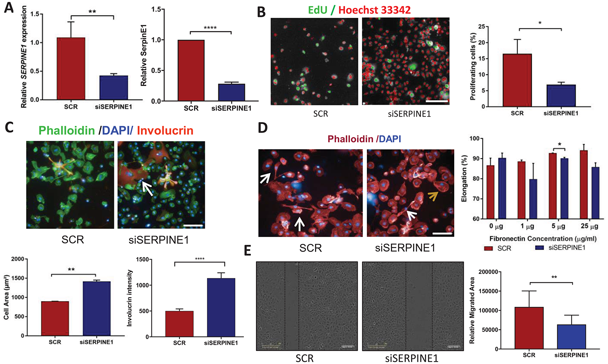 Cell phenotypes resulting from SERPINE1 knockdown