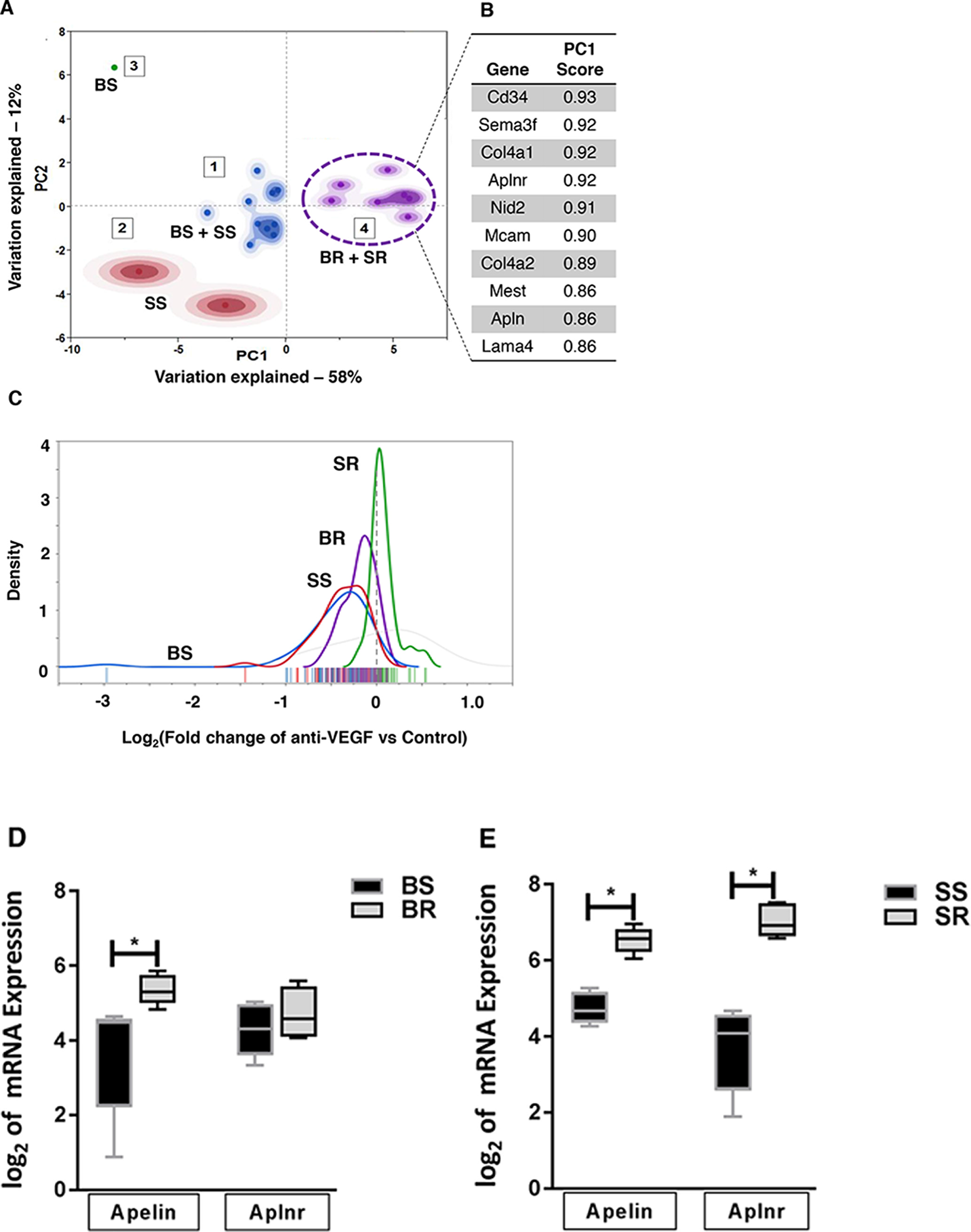 PCA analysis of stromal genes associated with resistant tumor phenotype