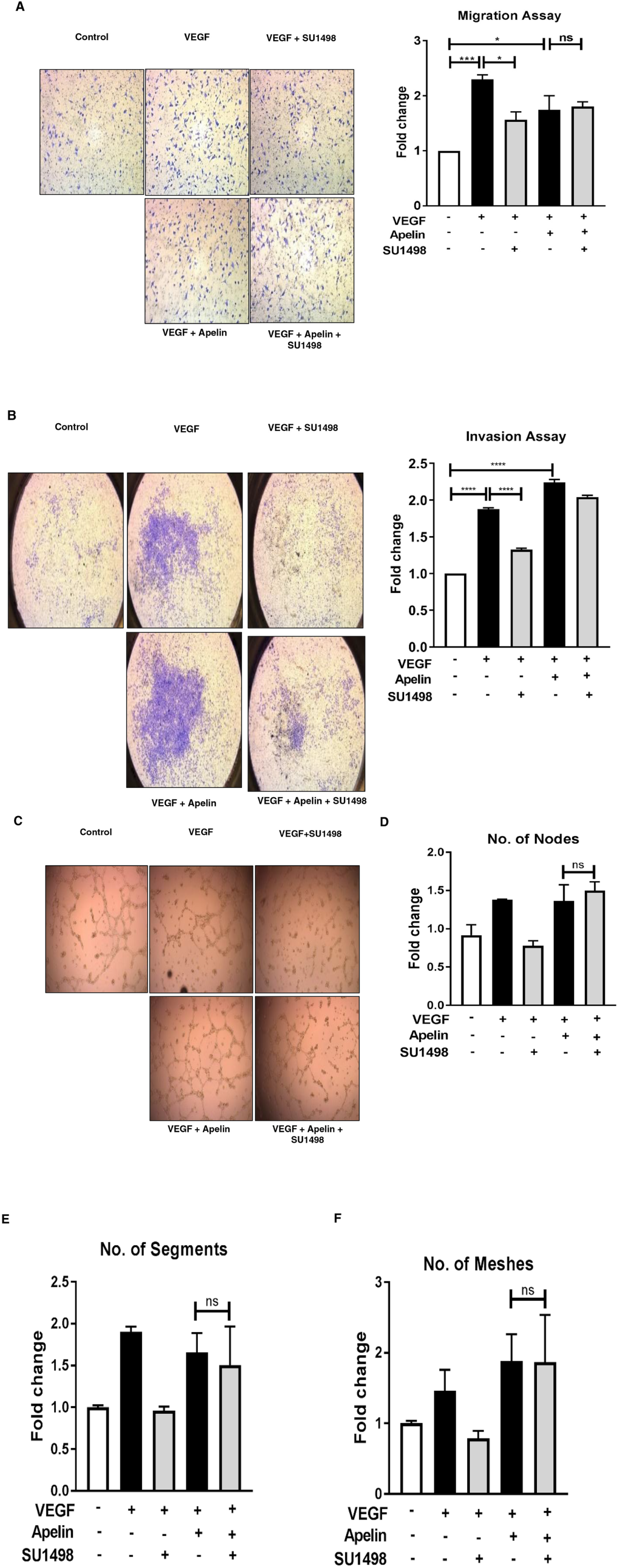 Apelin/APJ pathway contributes to reduced response to anti-angiogenic treatment in endothelial cells
