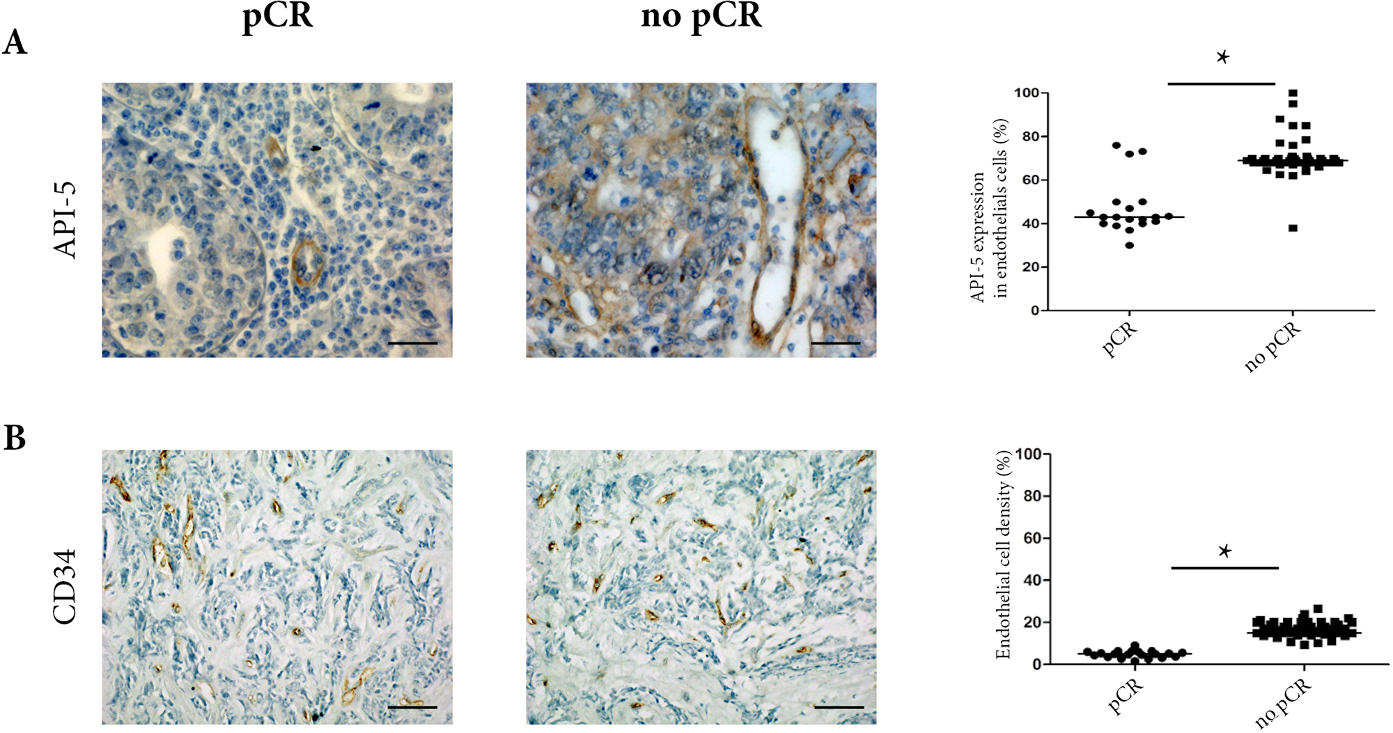 Clinical analyses of 78 TNBC biopsies from pCR and non-pCR patients before any treatment