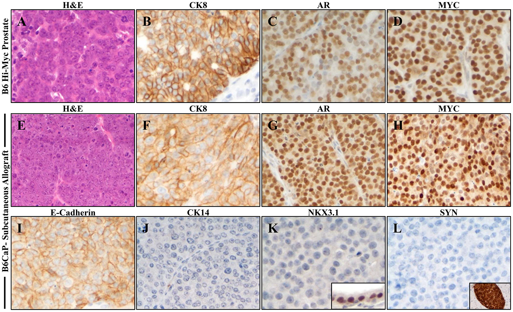B6CaP allograft recapitulates luminal epithelial phenotype of autochthonous Myc-driven prostate cancer