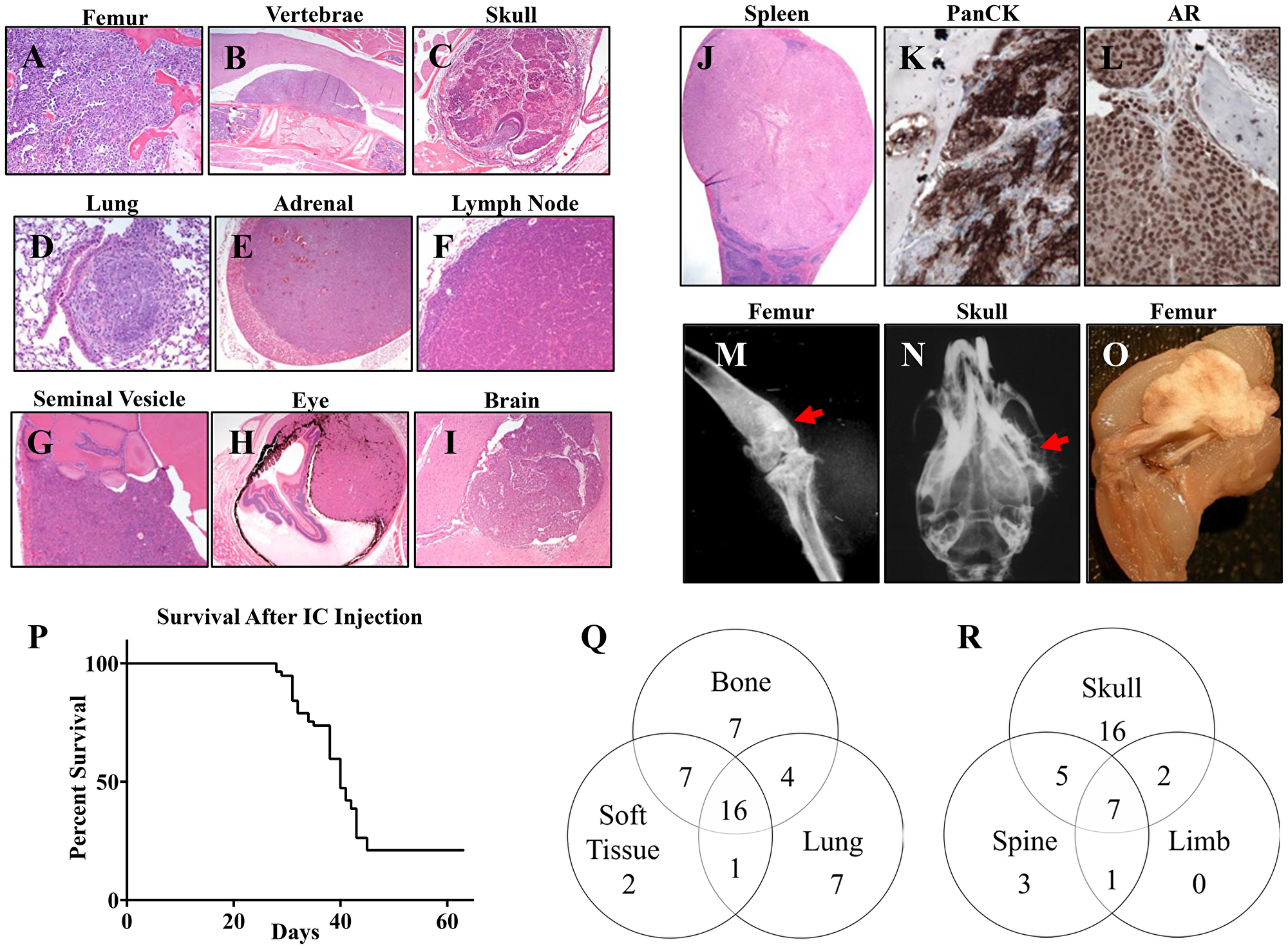 Intracardiac injection of B6CaP cells generates widespread bone and soft tissue metastases