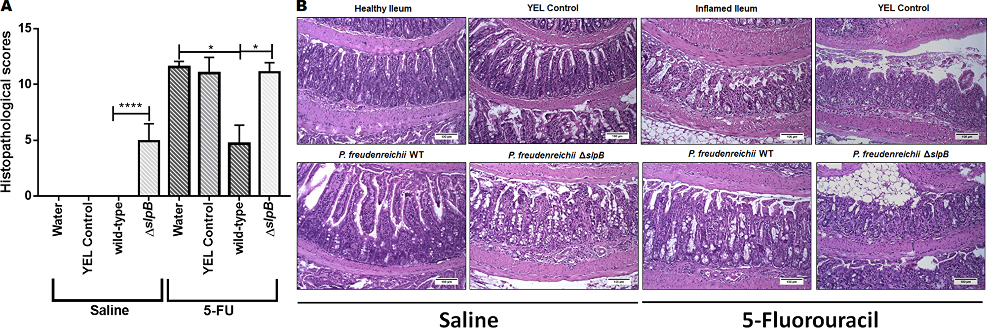 Propionibacterium freudenreichii WT strain alleviates mucosal damage in the ileum of 5-FU-treated mice while mutant strain P. freudenreichii ΔslpB causes inflammation in healthy mice