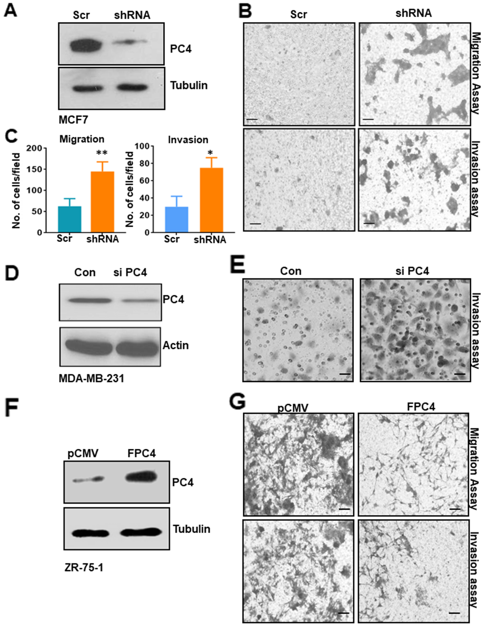 PC4 downregulation in breast cancer cell line enhances its tumorigenic properties