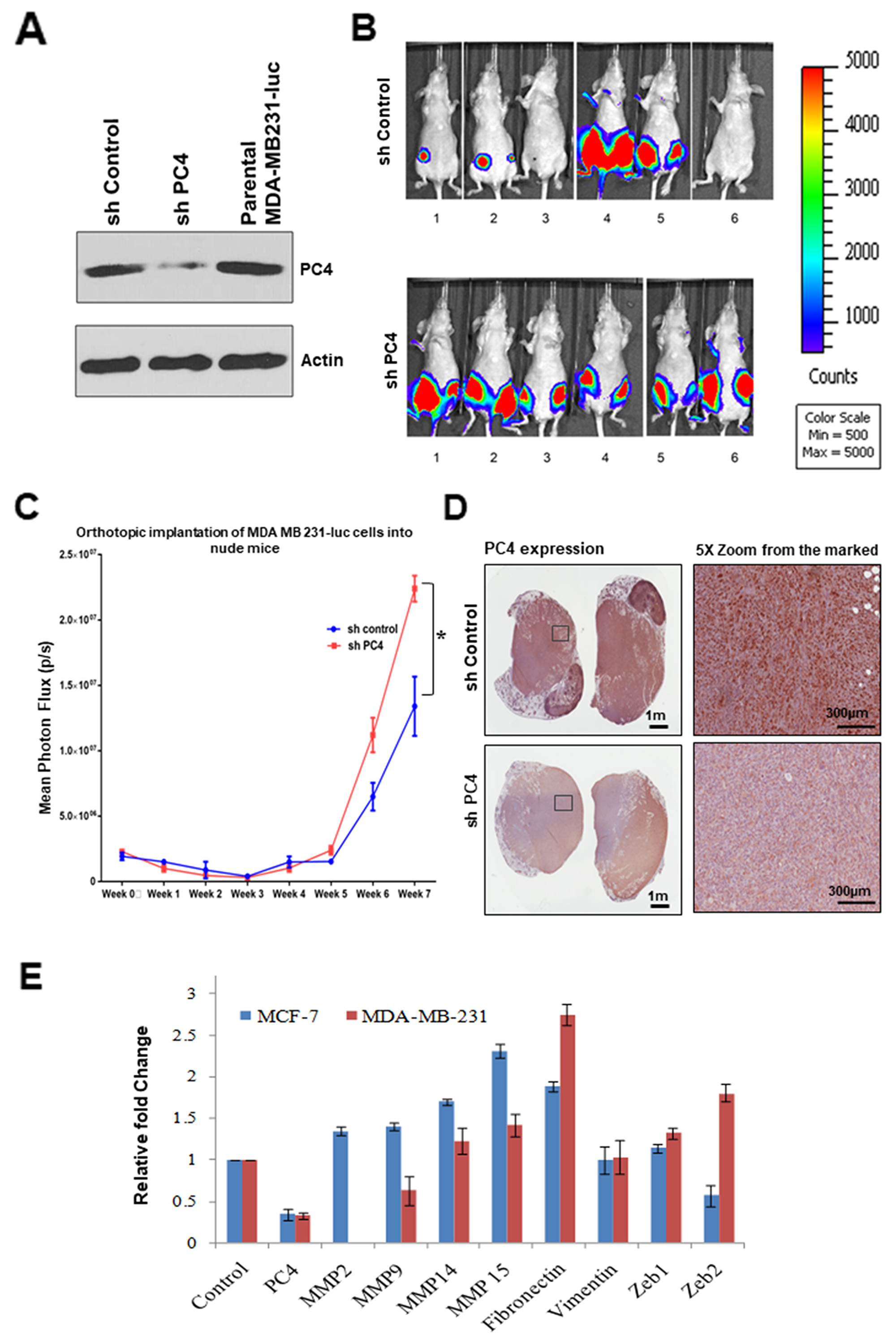 Downregulation of PC4 suppresses tumour progression in orthotopic breast cancer mice-model