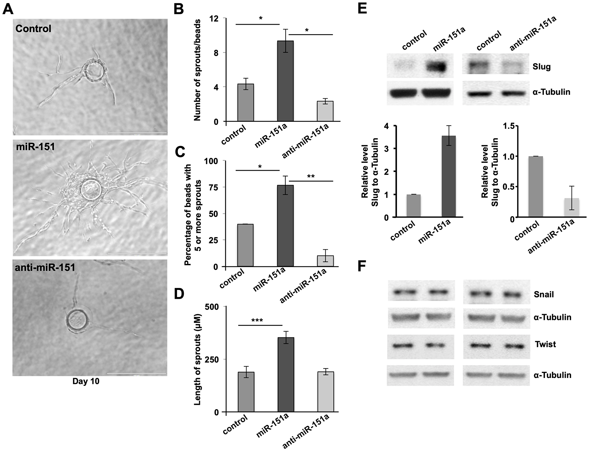 miR-151a enhances EC angiogenesis and induces the amount of Slug protein