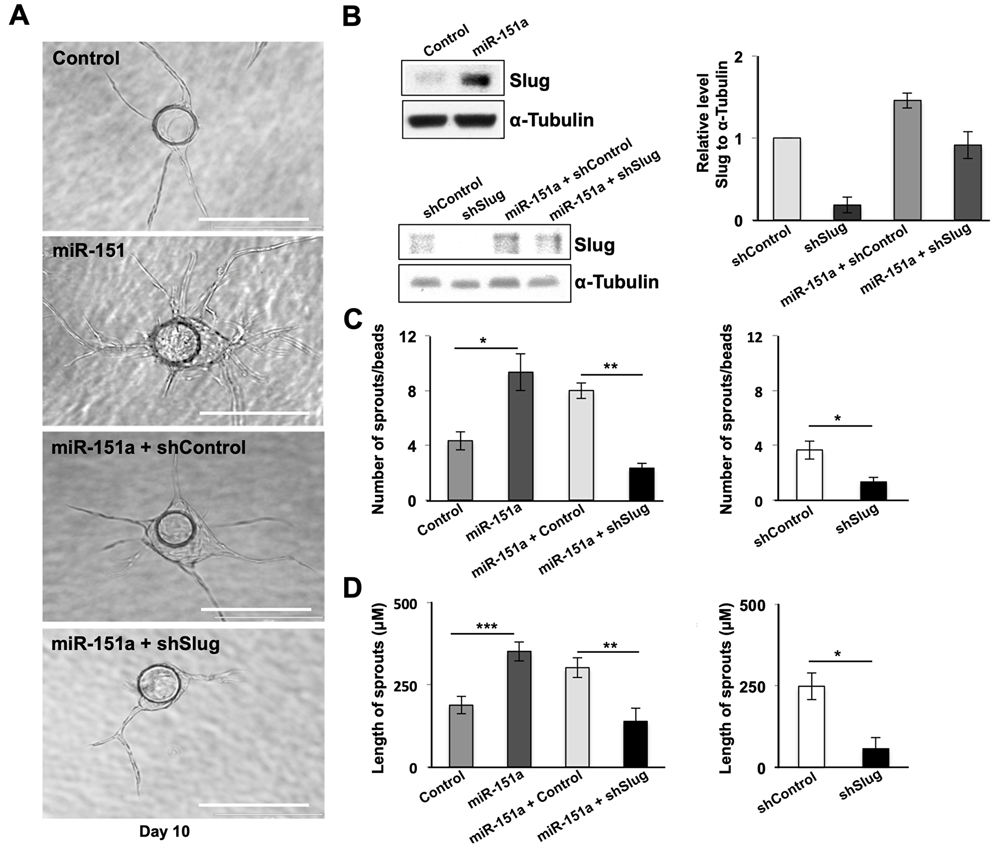 miR-151a enhanced EC angiogenesis is dependent on Slug induction