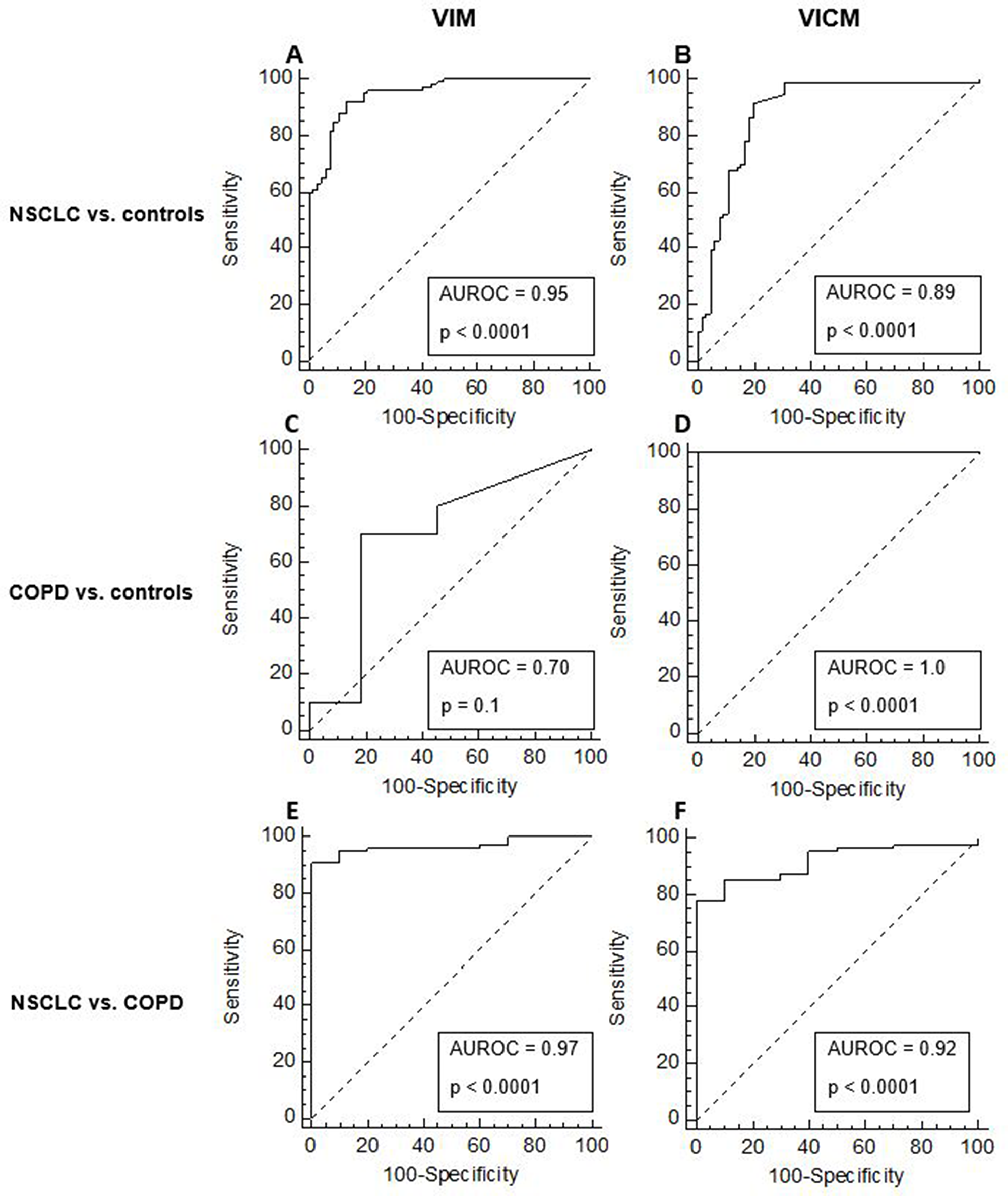 Diagnostic power of MMP-degraded vimentin (VIM) and MMP-degraded and citrullinated vimentin (VICM) for separating non-small cell lung cancer (NSCLC) and chronic obstructive pulmonary disease (COPD) from healthy controls