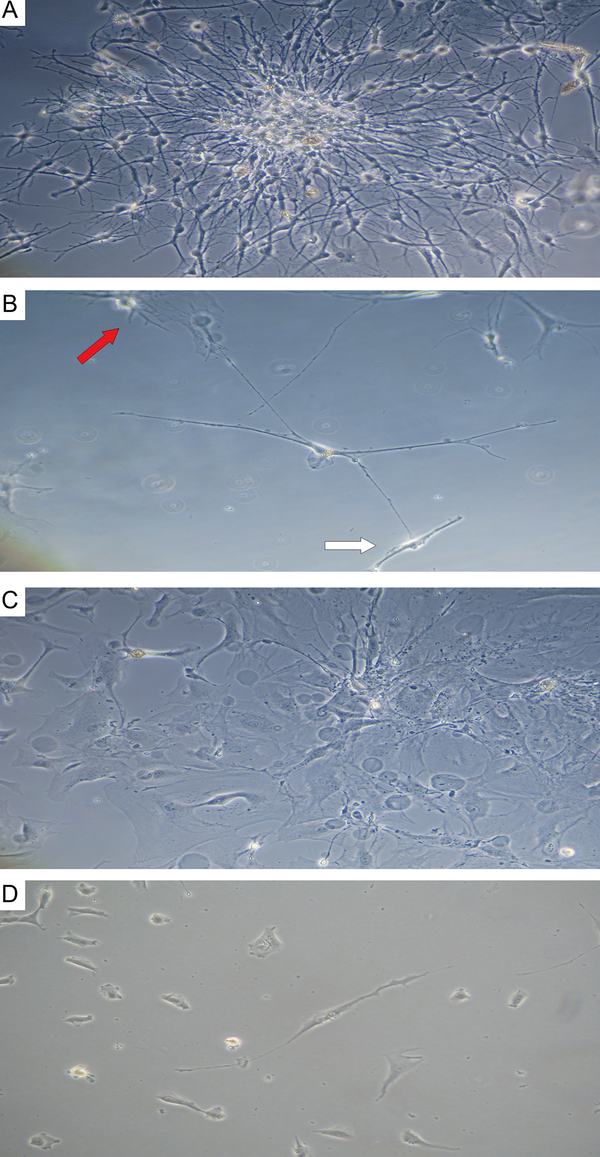 Astrocytoma and glioblastoma primary culture at 7 days
