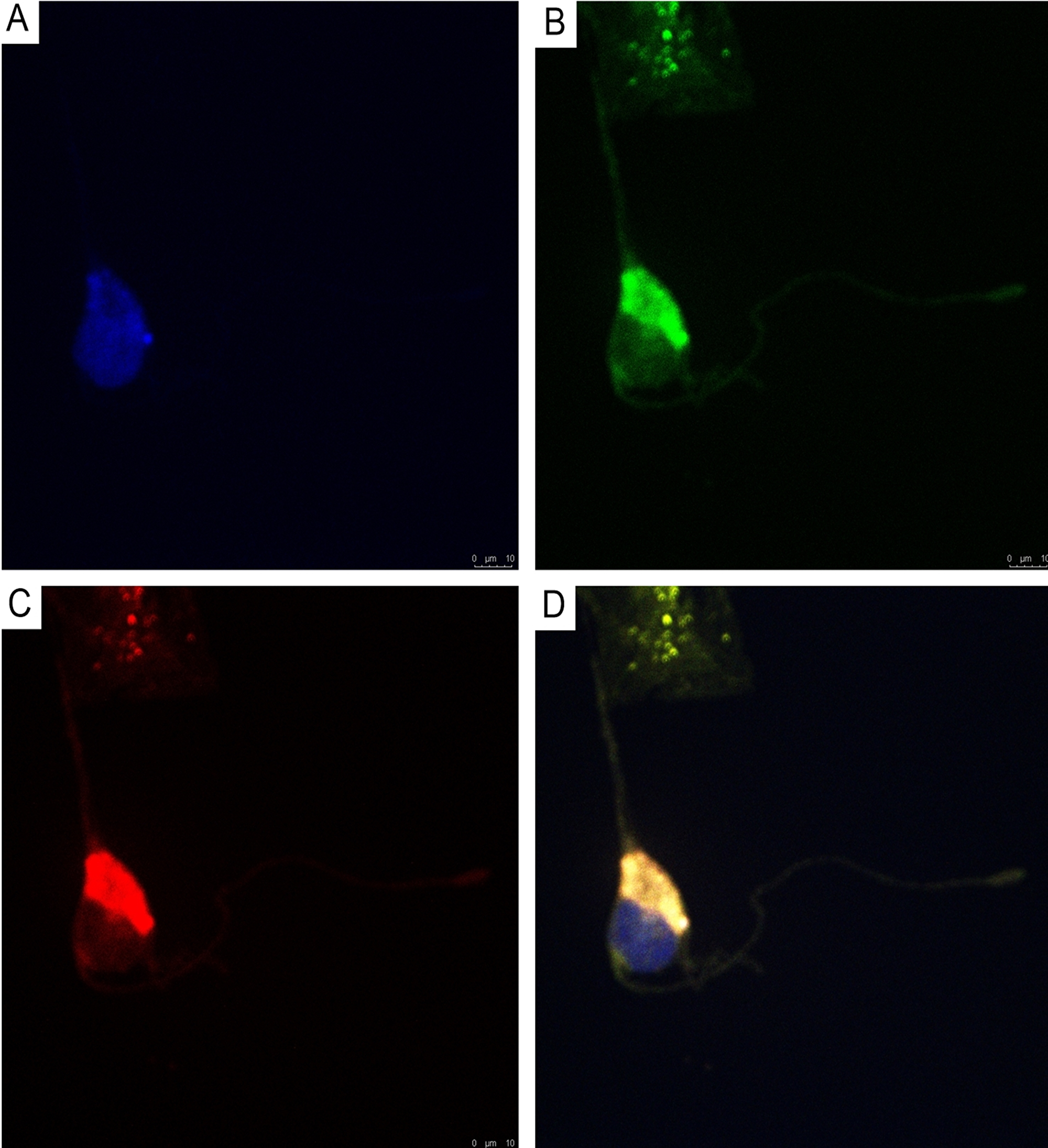CLSM of astocytoma primary culture