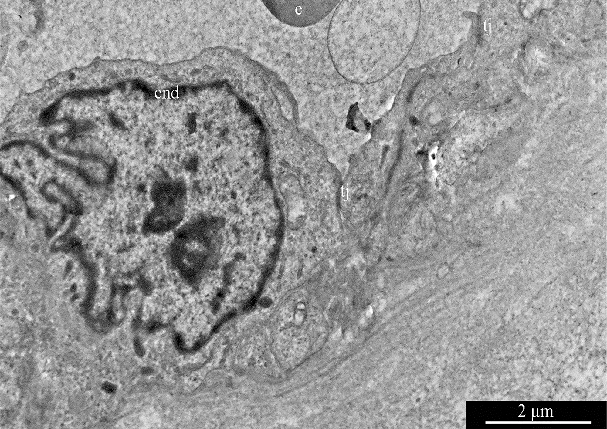 Glioblastoma blood capillary