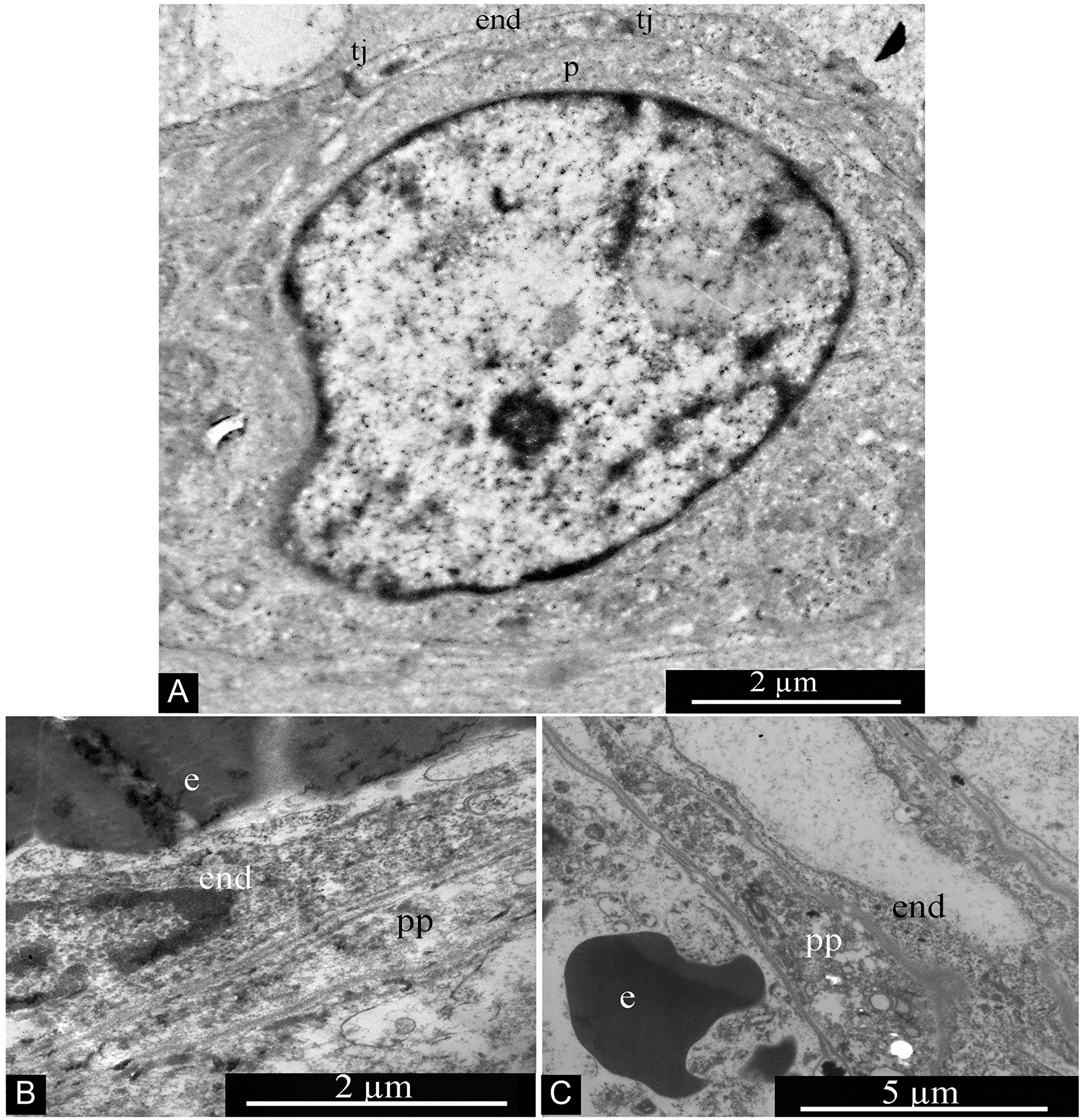 Pericytes in glioblastoma blood capillary