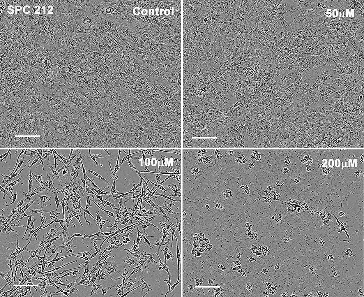 Stronger cytotoxic effect of FCF on the population of SPC212 cells with epithelioid morphology than cells with sarcomatoid morphology