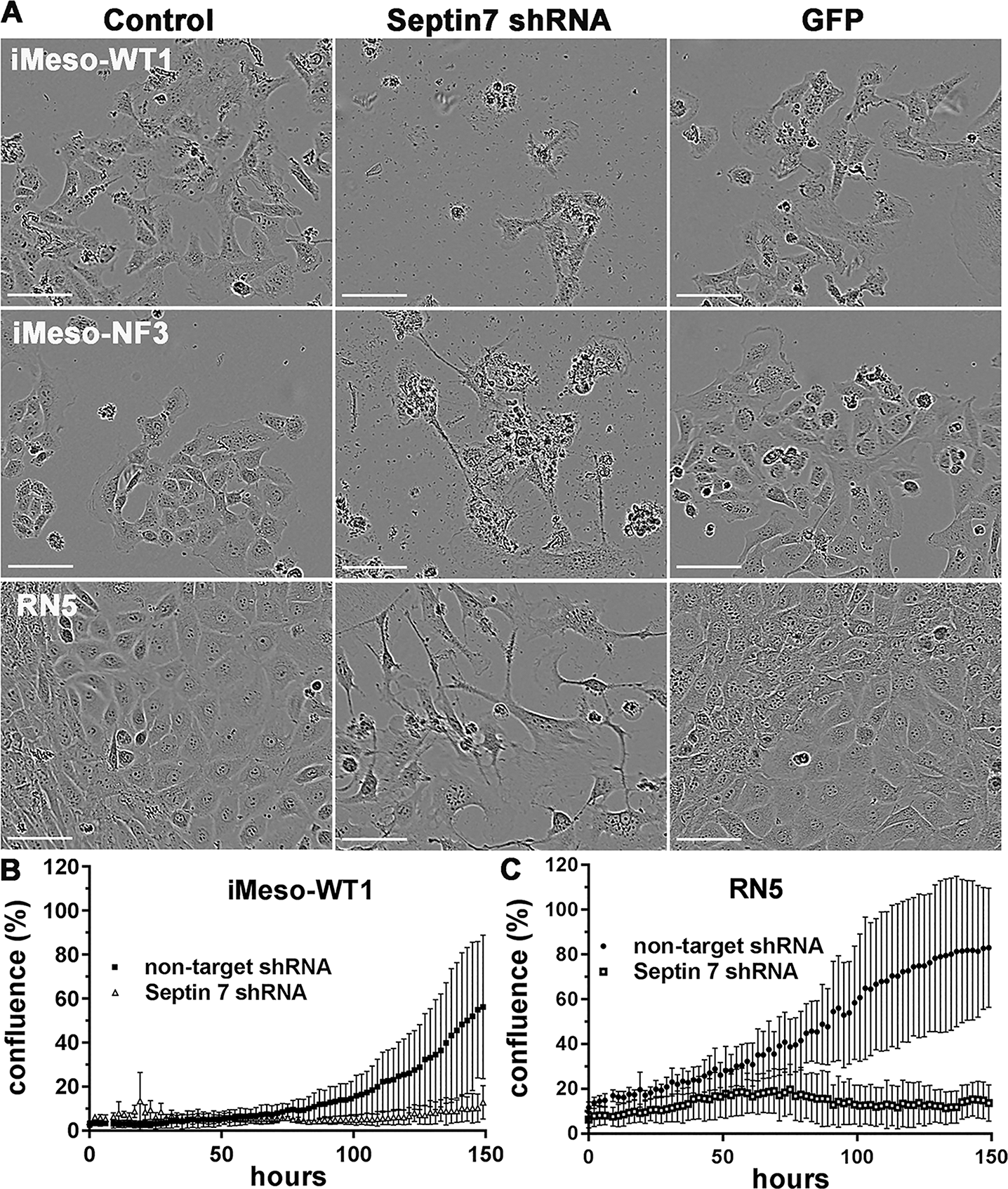 Septin 7 downregulation decreases viability of both murine immortalized mesothelial cells and MM cells