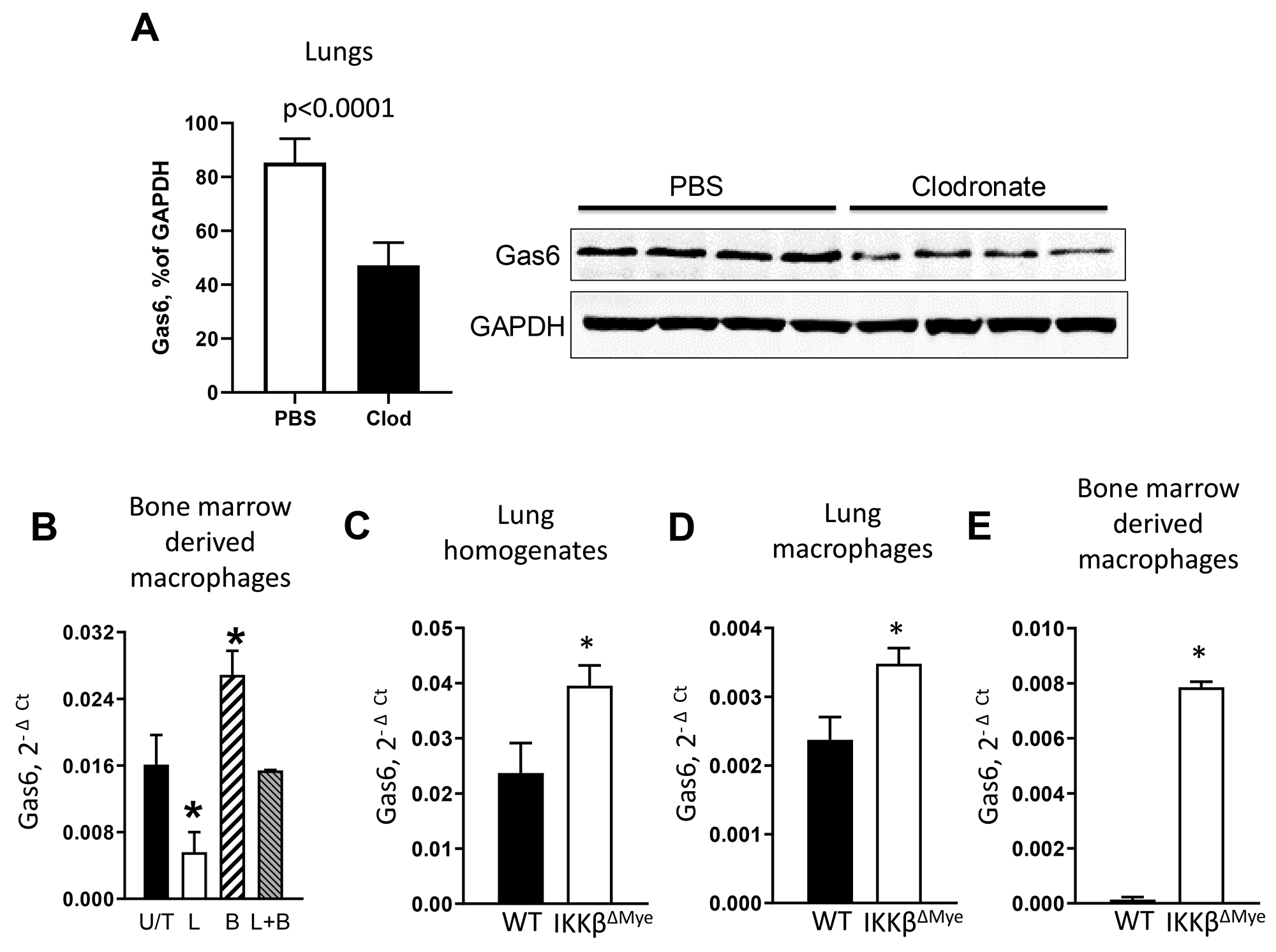 NF-κB down-regulates Gas6 expression in myeloid cells