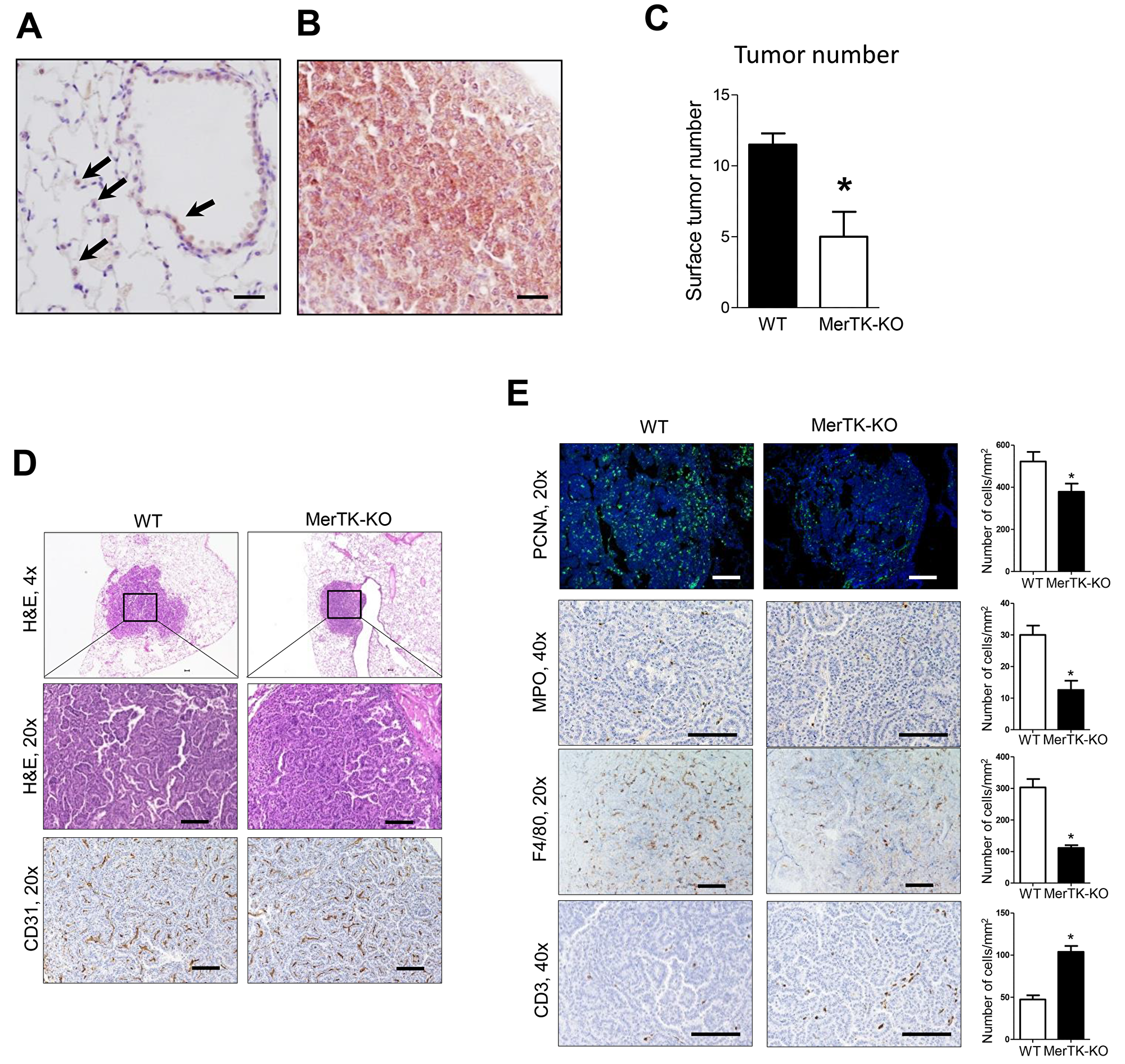 Reduced lung tumorigenesis in MerTK deficient mice