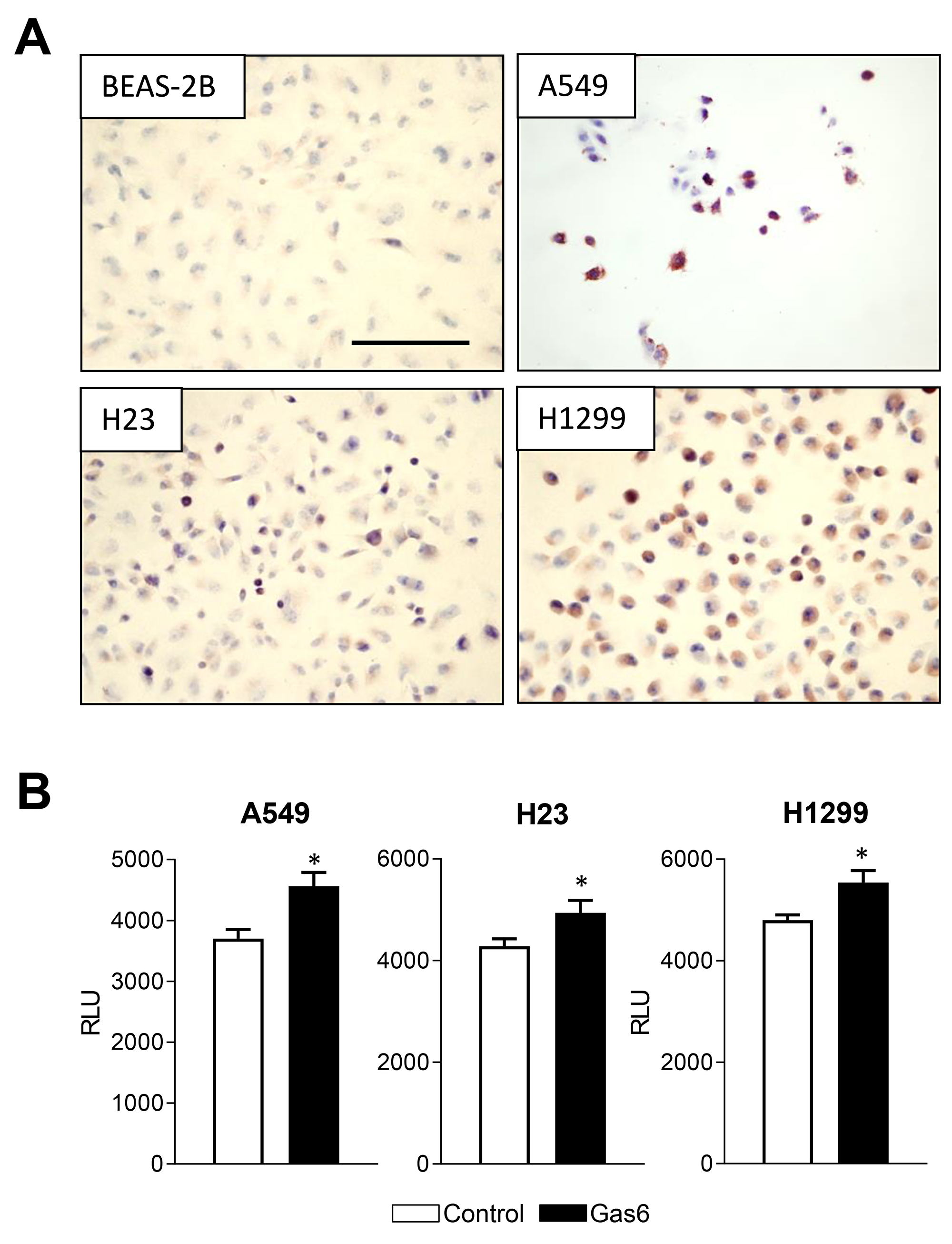 Gas6 promotes proliferation of human lung cancer cells