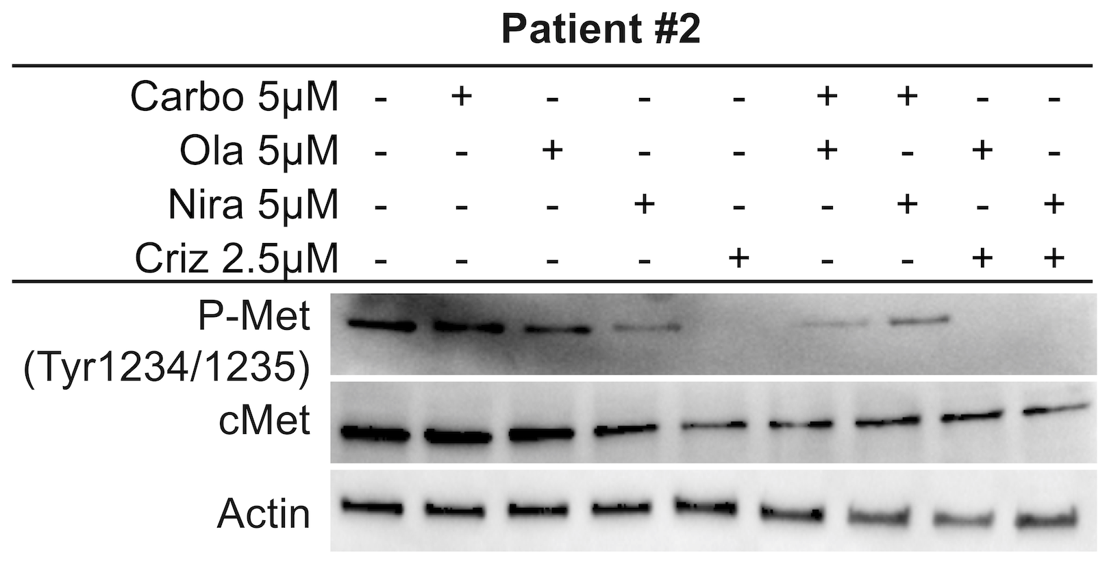 c-Met inhibition in Patient #2