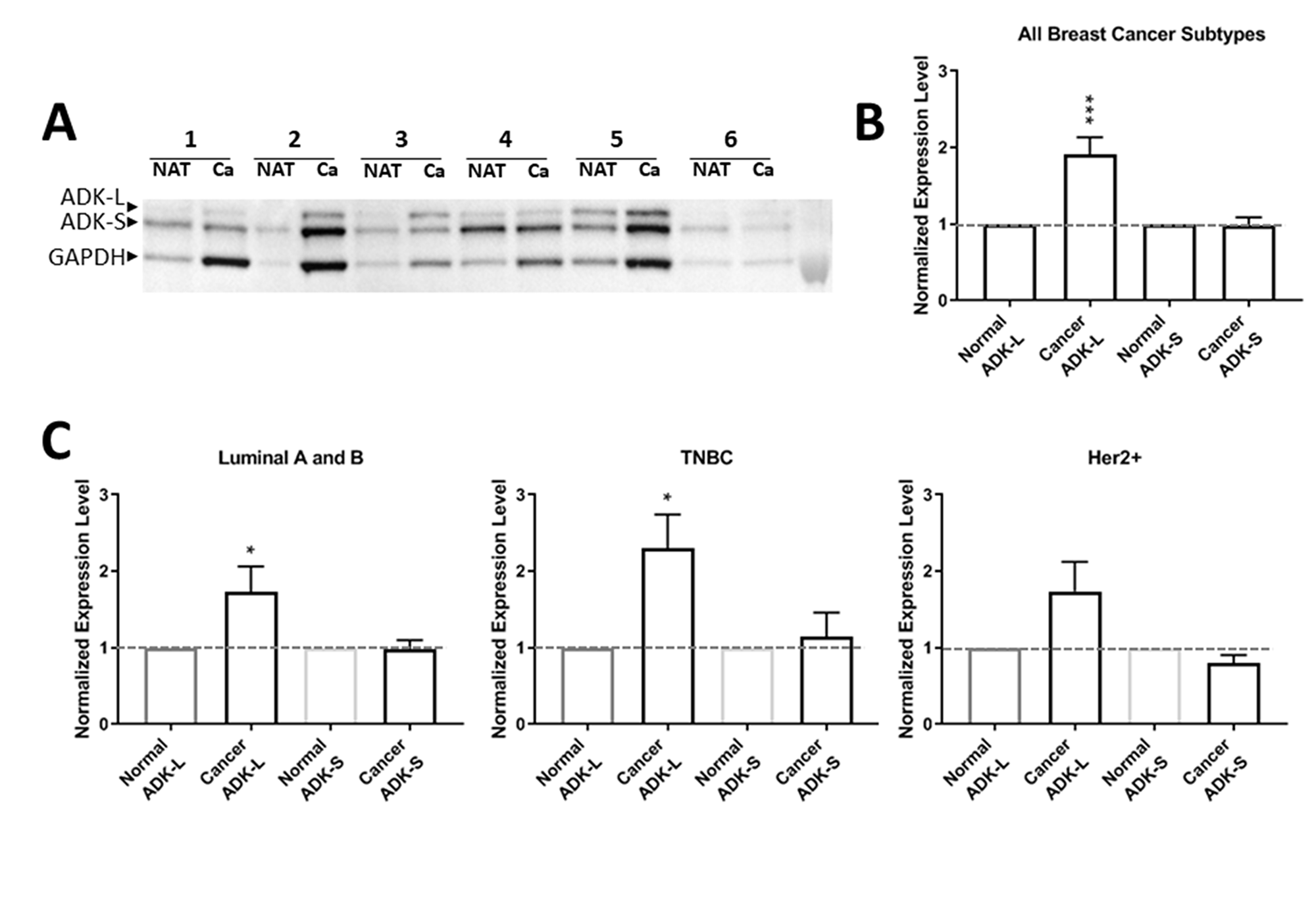 Expression profiles of ADK isoforms in cancer tumor versus NAT from 46 patients