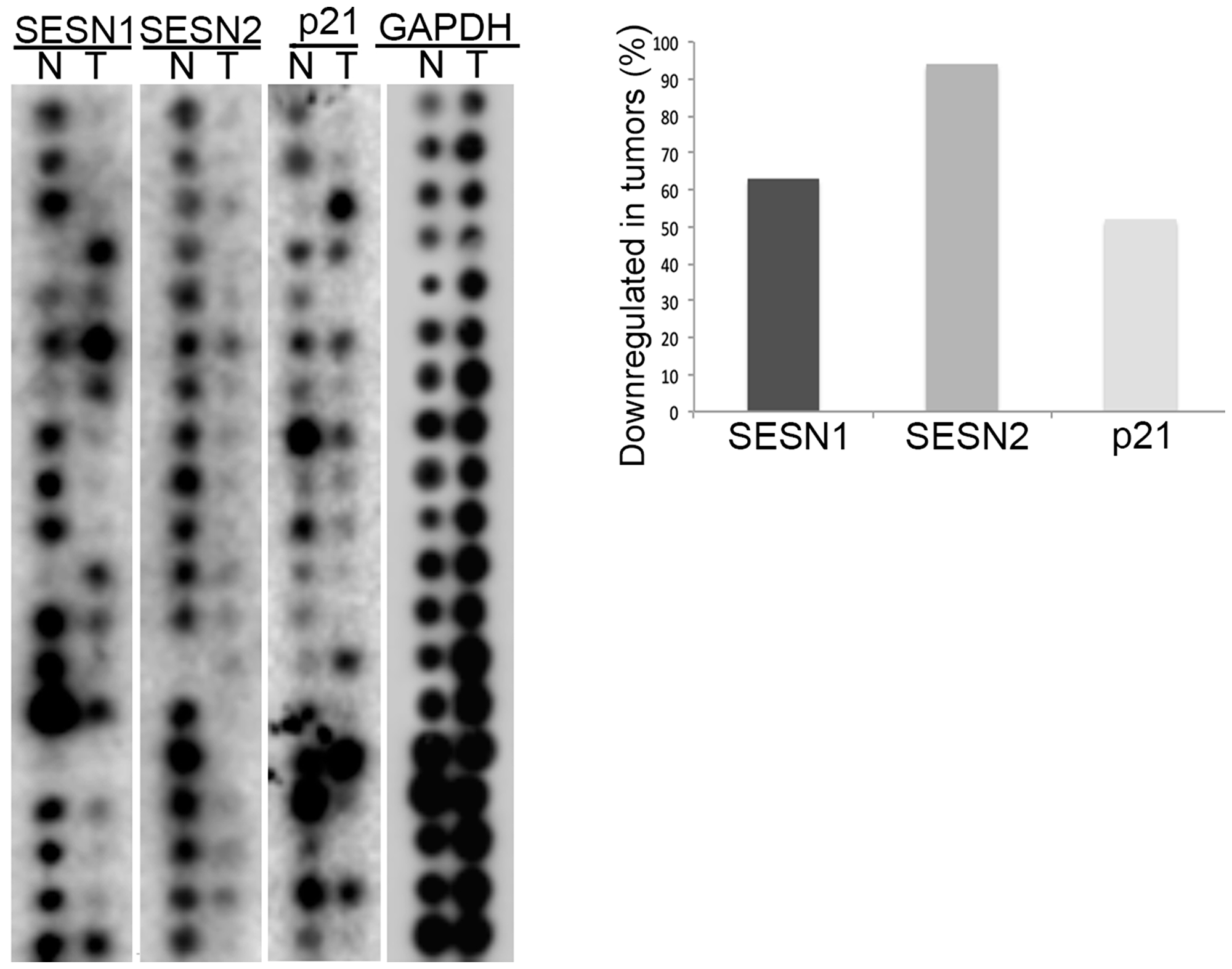 The expression of SESN1 and SESN2 genes is decreased in human lung tumors