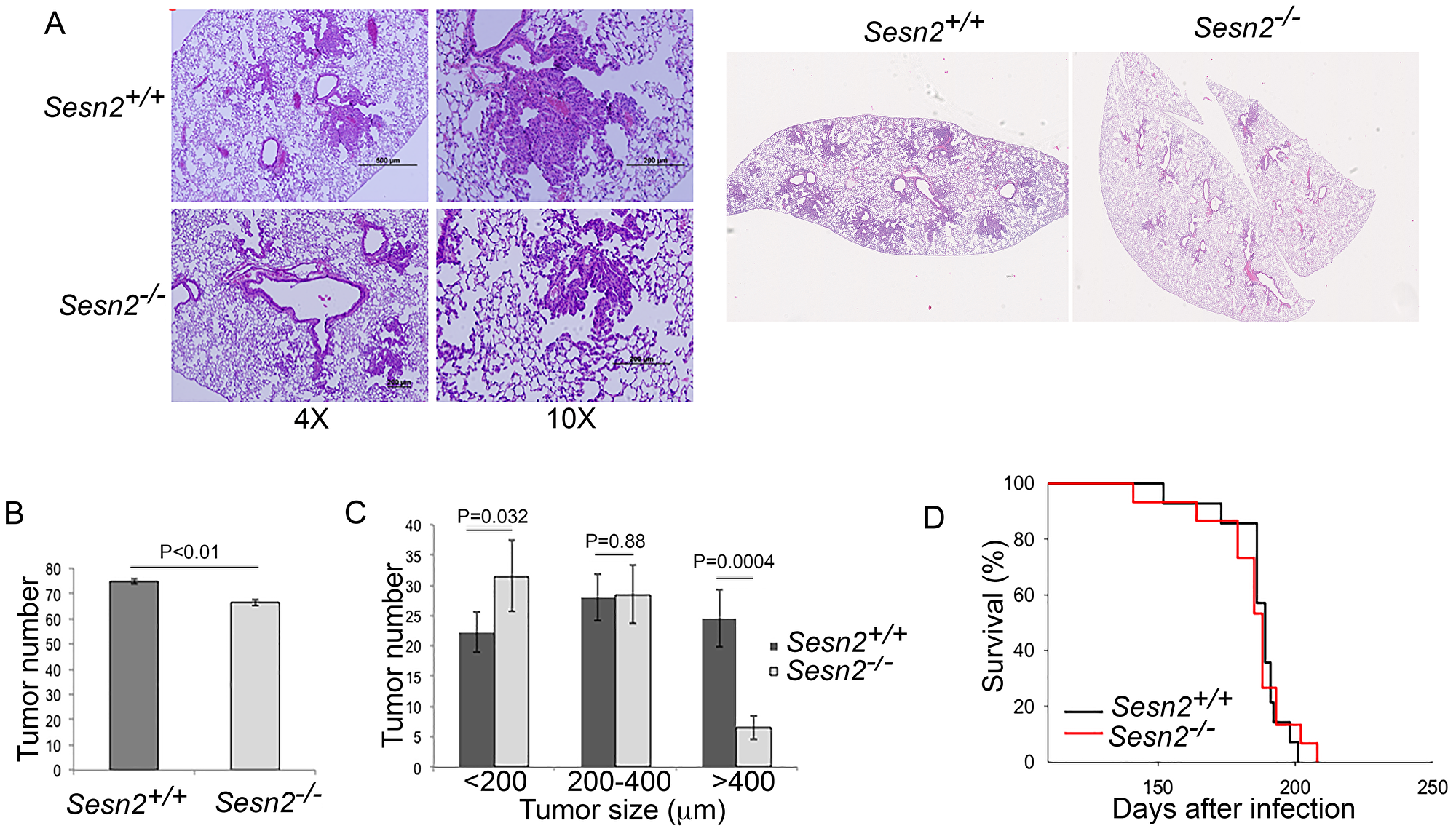 Sesn2 inactivation does not affect tumor initiation and life expectancy in tumor-bearing mice but slows down tumor growth